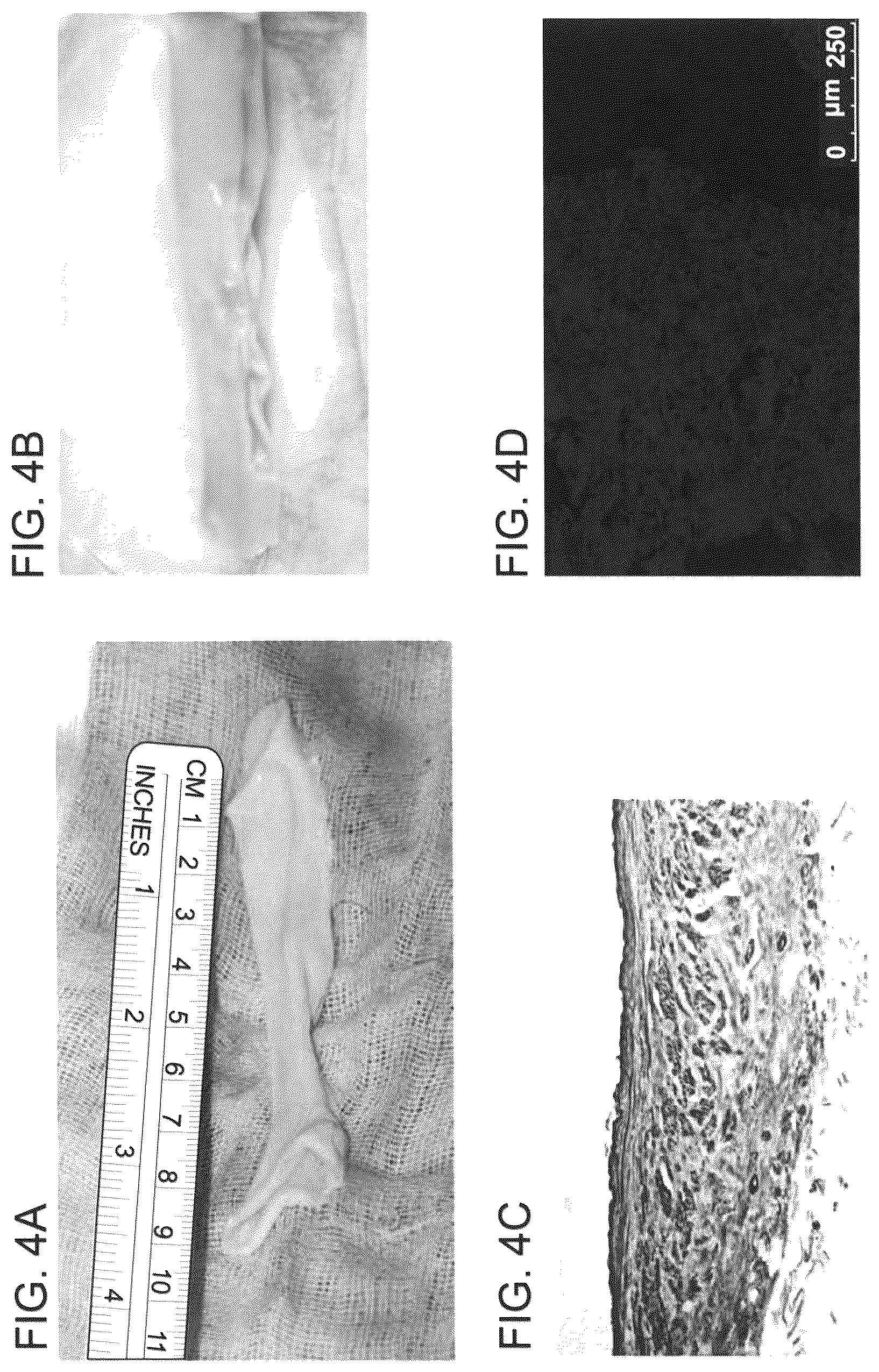 Patent US12090253 Figure 7 – Bioengineered allogeneic blood vessel