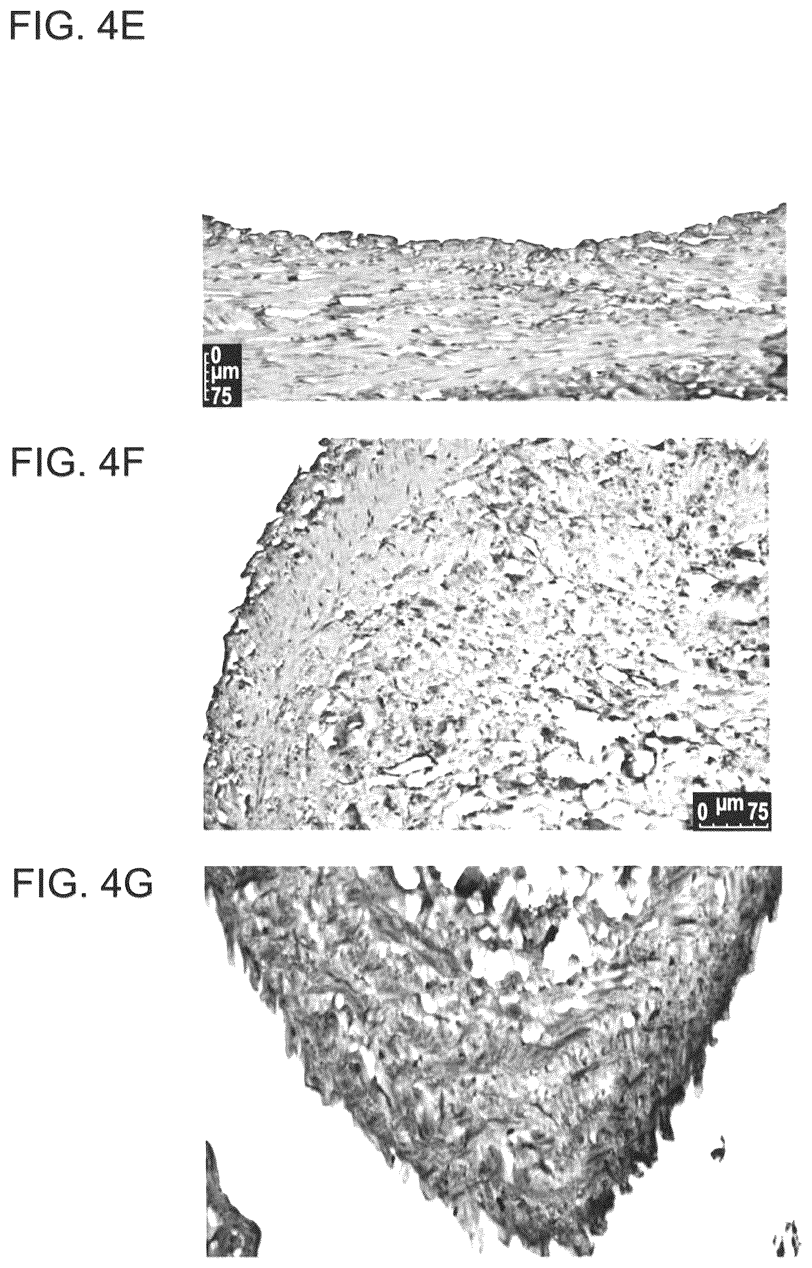 Patent US12090253 Figure 8 – Bioengineered allogeneic blood vessel