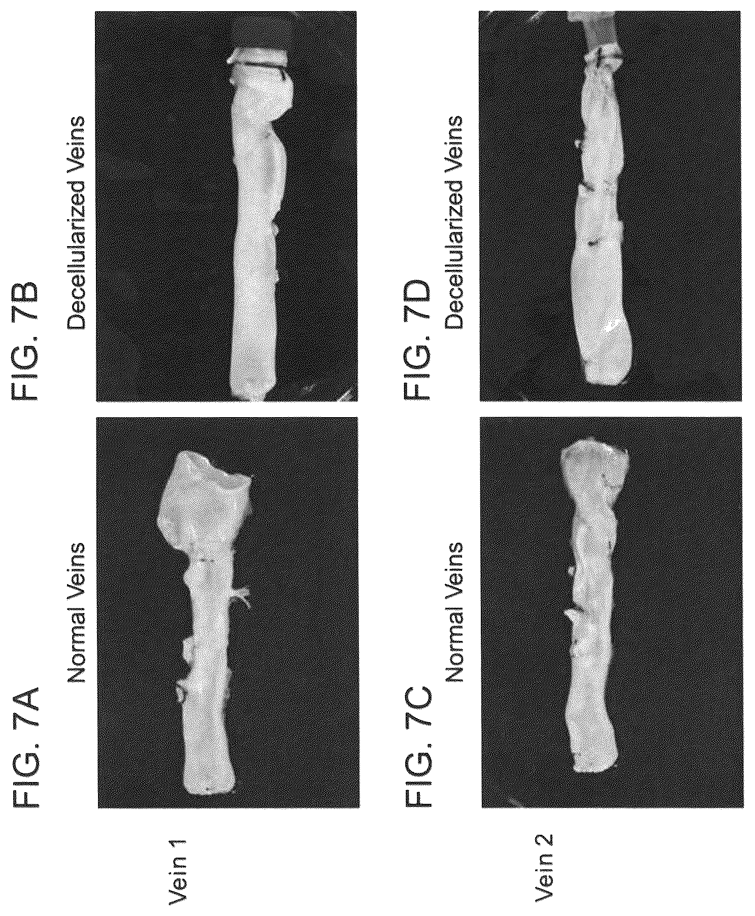 Patent US12090253 Figure 13 – Bioengineered allogeneic blood vessel