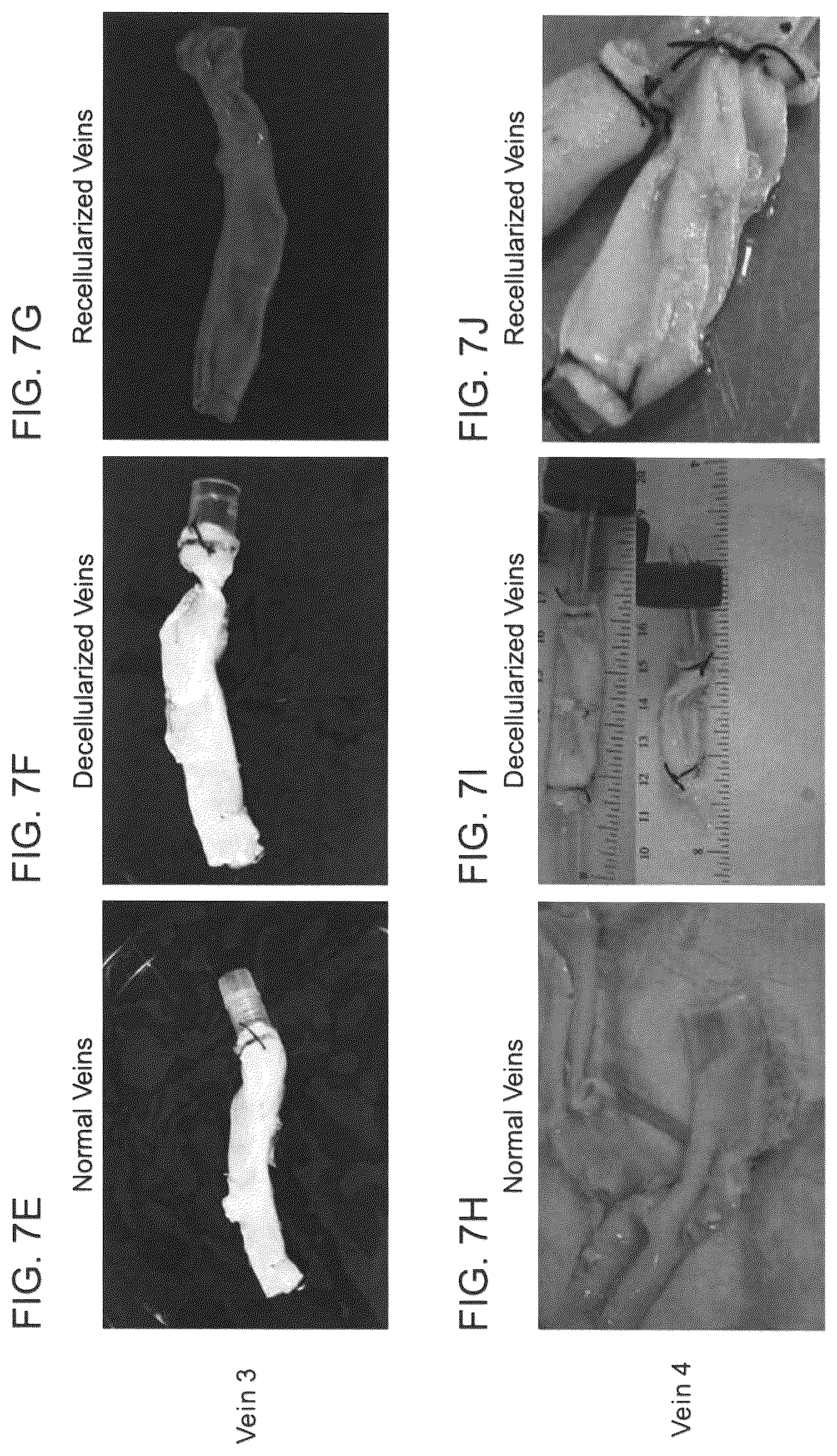 Patent US12090253 Figure 14 – Bioengineered allogeneic blood vessel