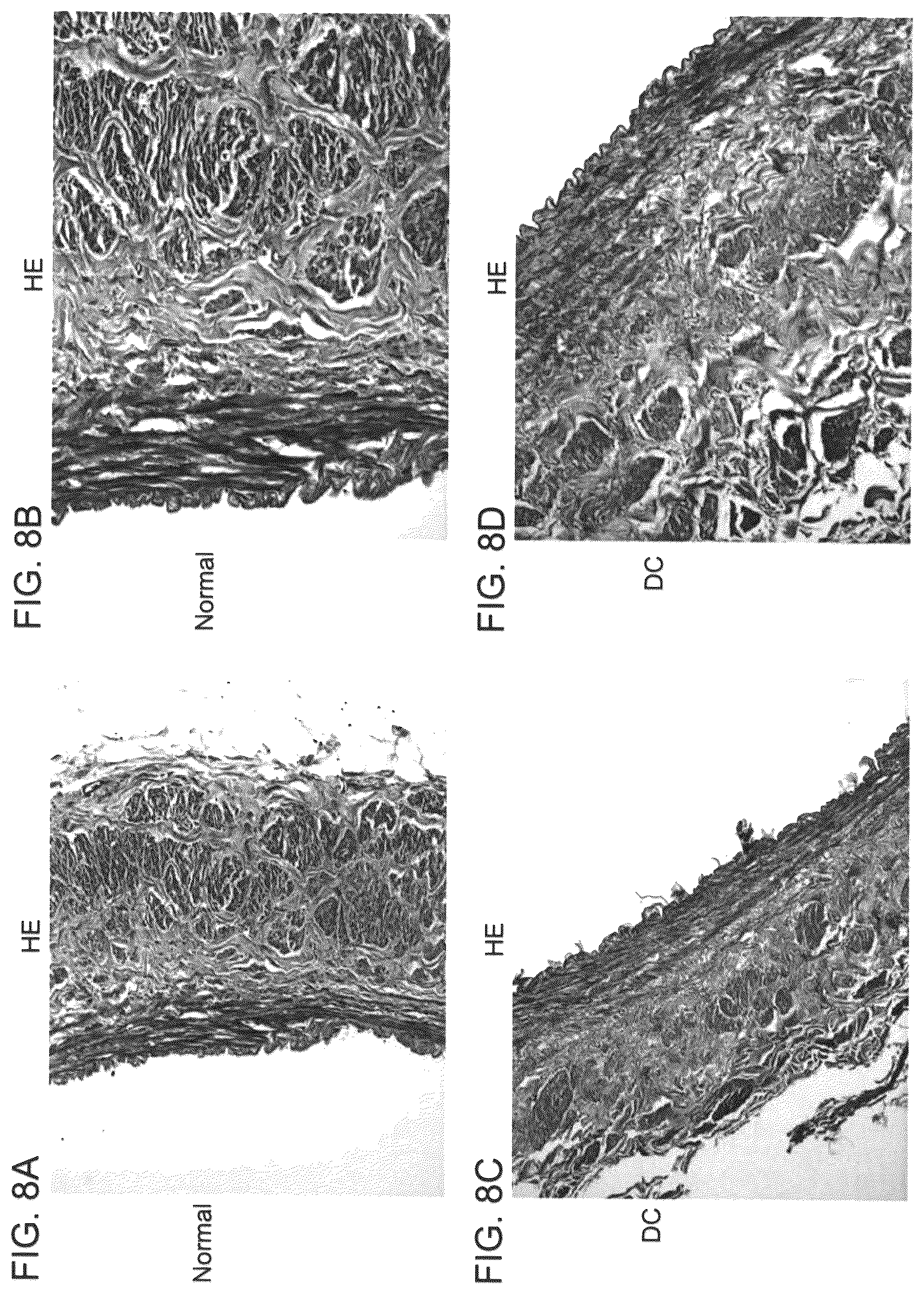 Patent US12090253 Figure 15 – Bioengineered allogeneic blood vessel