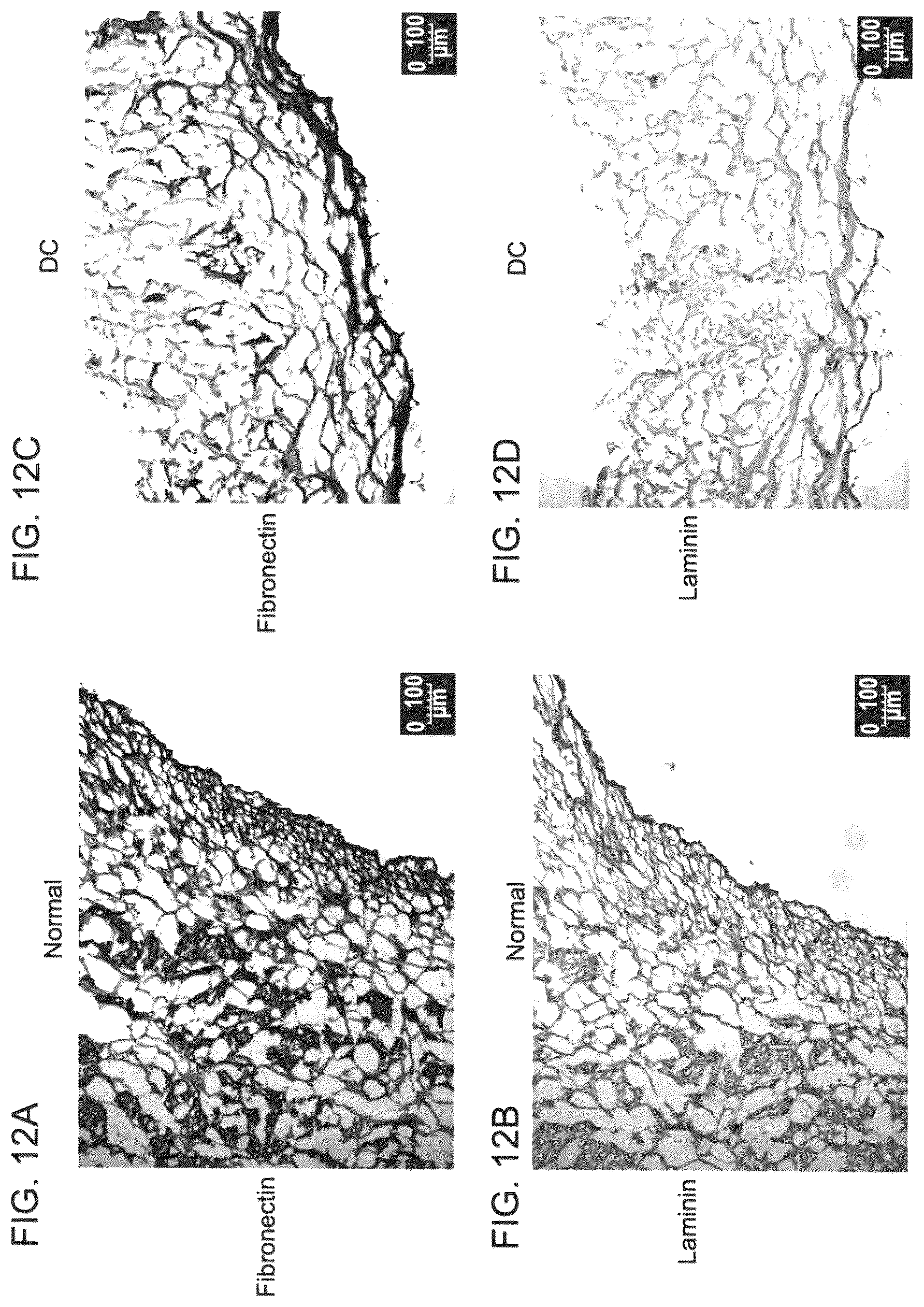 Patent US12090253 Figure 19 – Bioengineered allogeneic blood vessel