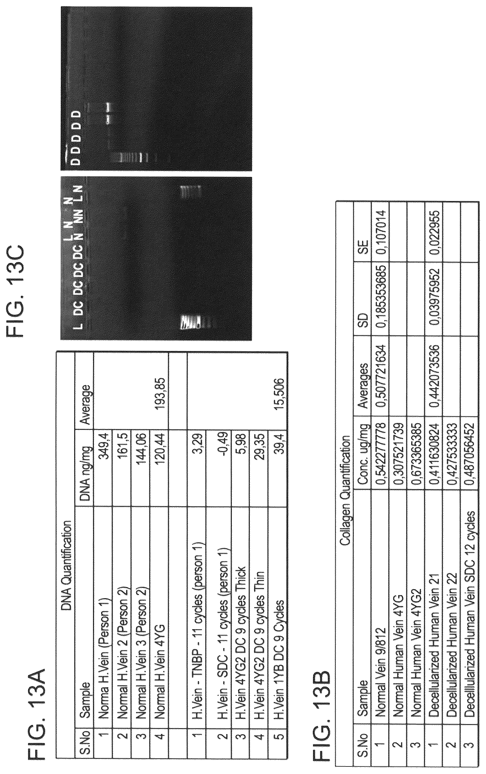 Patent US12090253 Figure 20 – Bioengineered allogeneic blood vessel