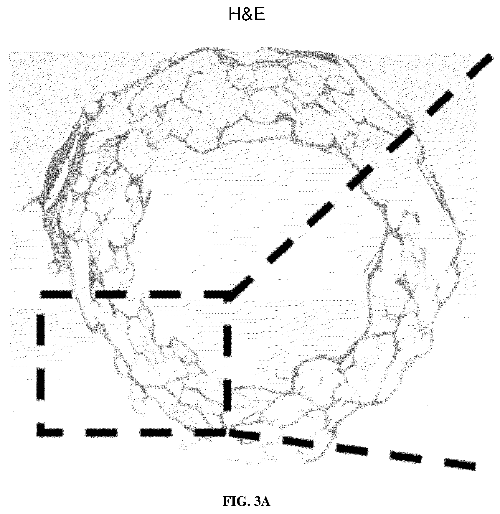 Patent US12090254 Figure 5 – Composite tubular material prepared from extracellular matrix and synthetic polymer, and preparation method thereof