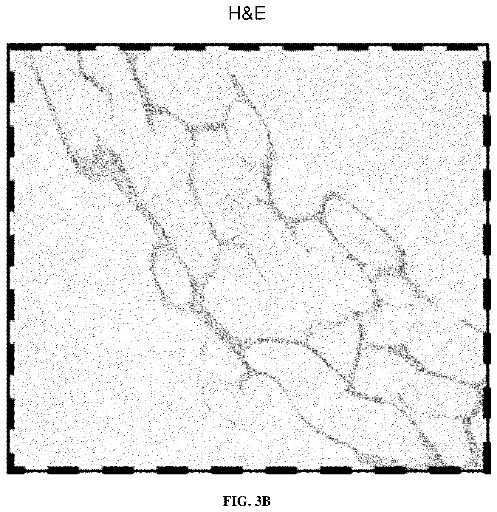 Patent US12090254 Figure 6 – Composite tubular material prepared from extracellular matrix and synthetic polymer, and preparation method thereof