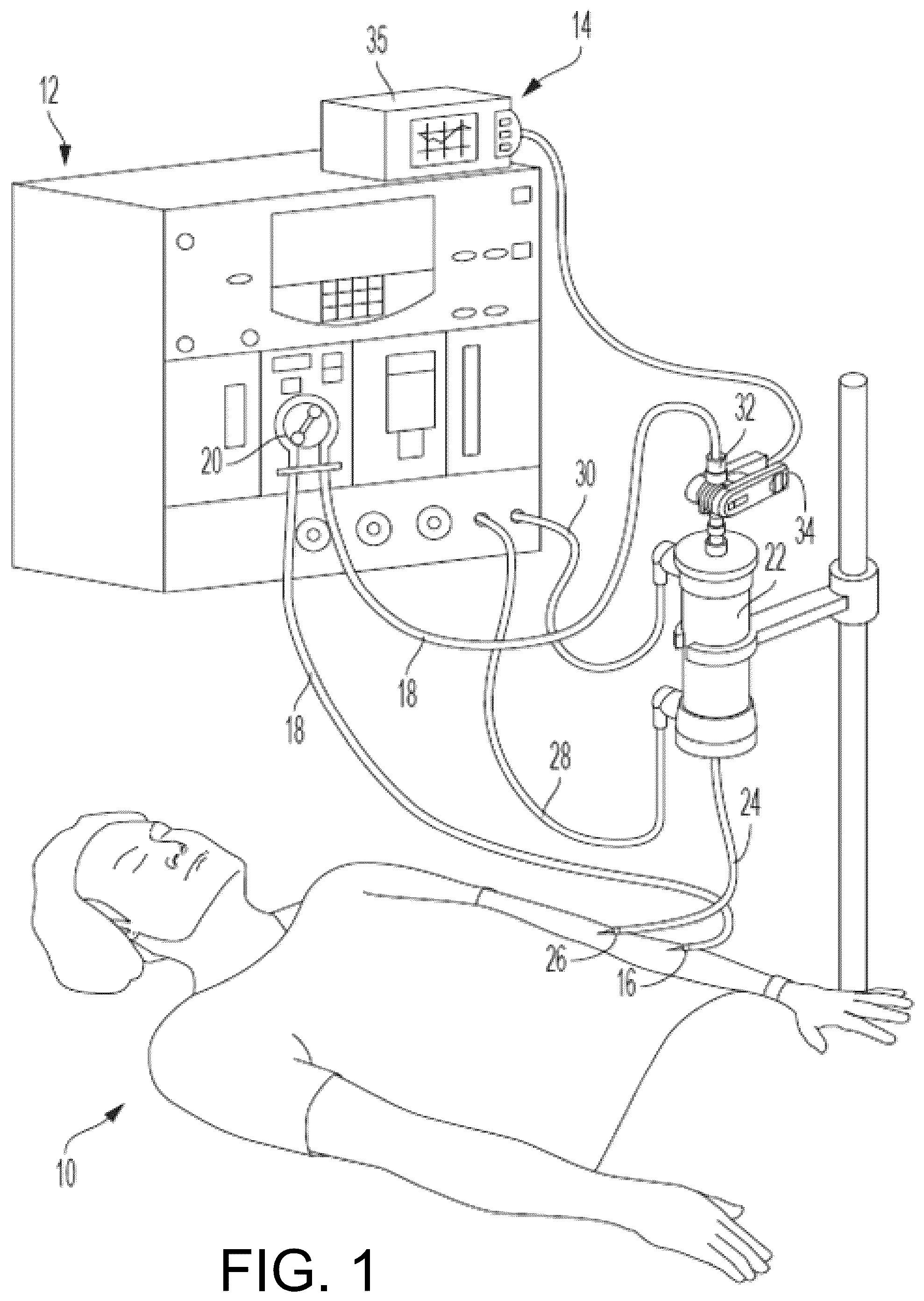 Patent US12090257 — Blood monitoring system for detecting occult hemorrhages — Figure 1