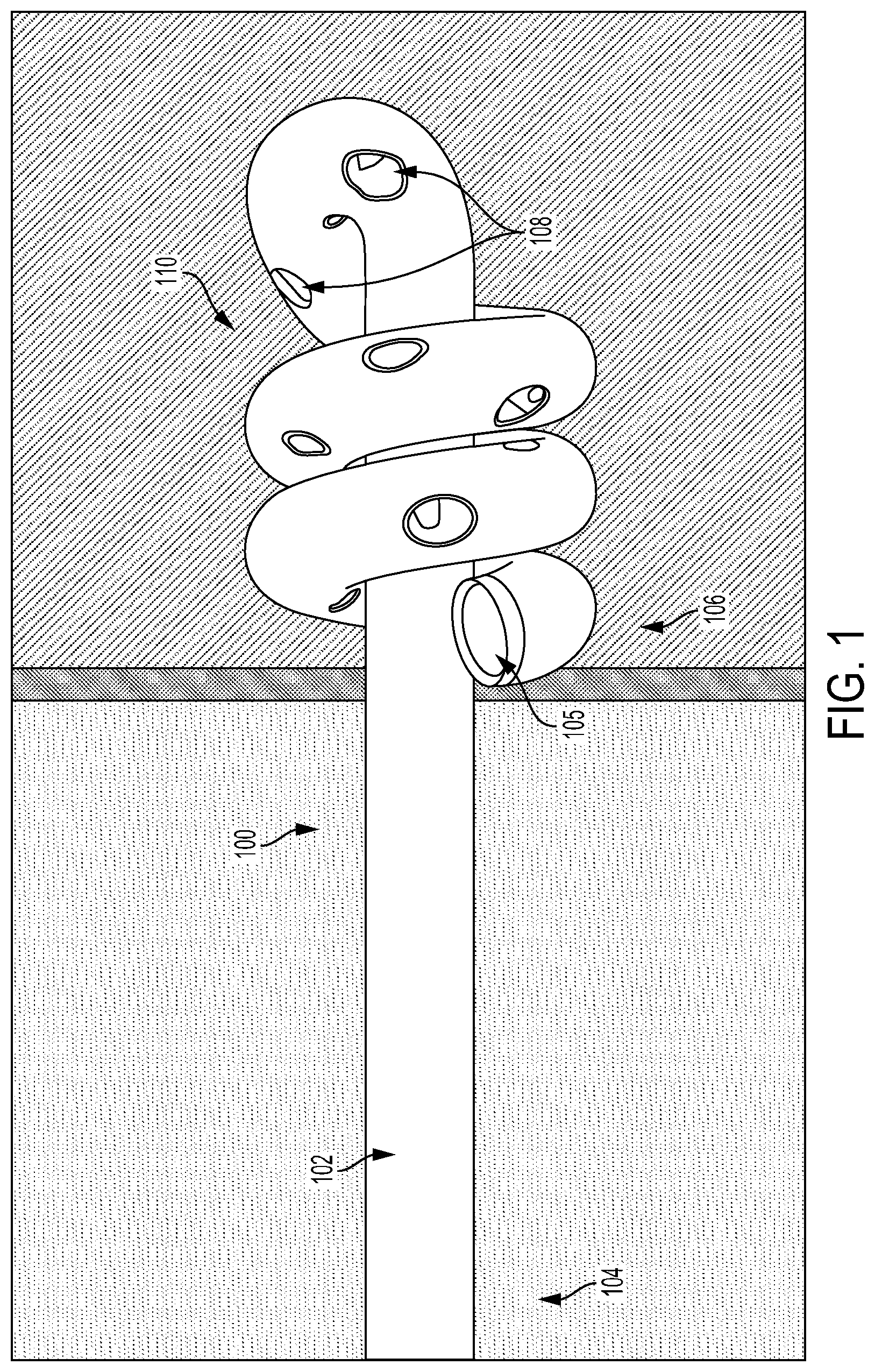 Patent US12090260 Figure 1 – Drainage or infusion catheter and method of use
