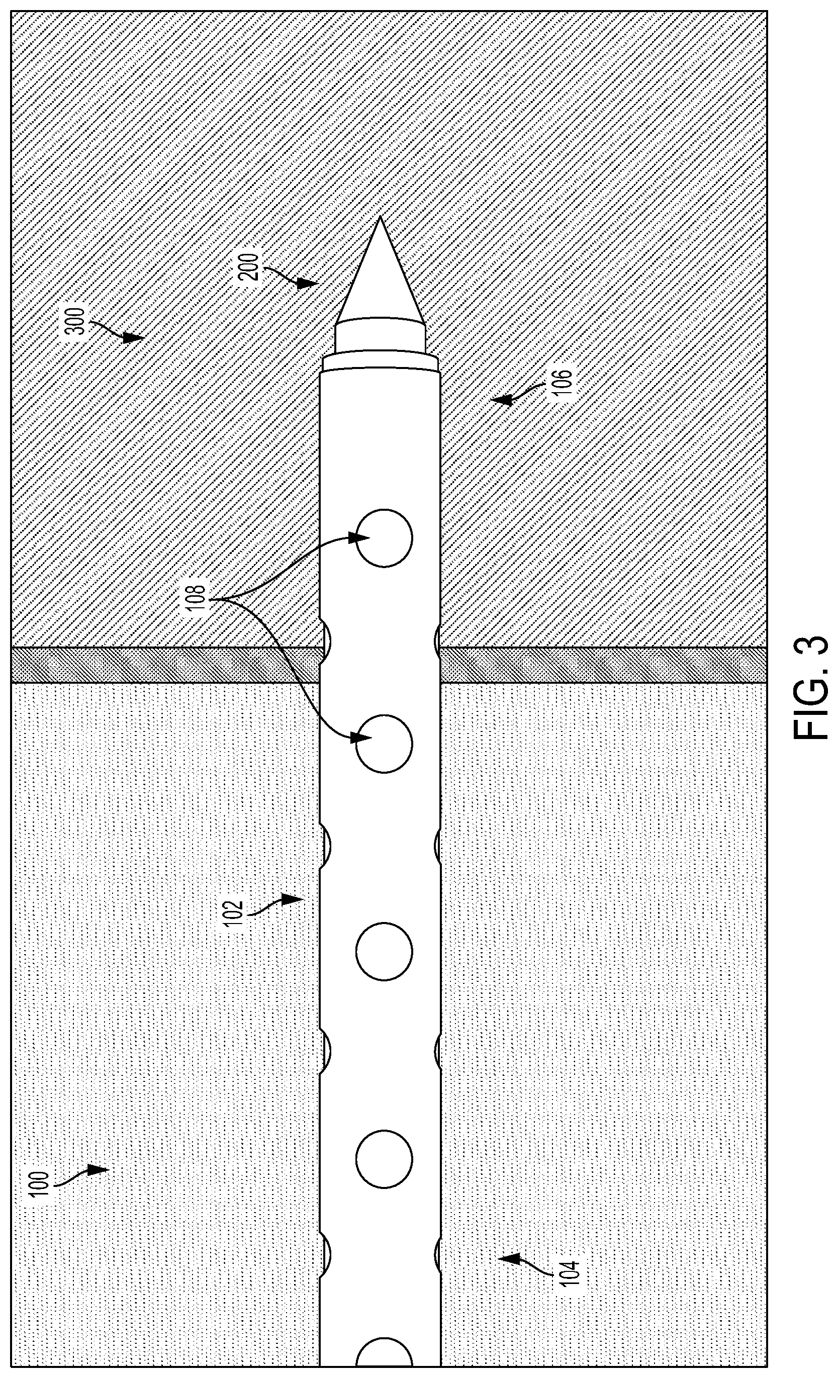 Patent US12090260 Figure 3 – Drainage or infusion catheter and method of use