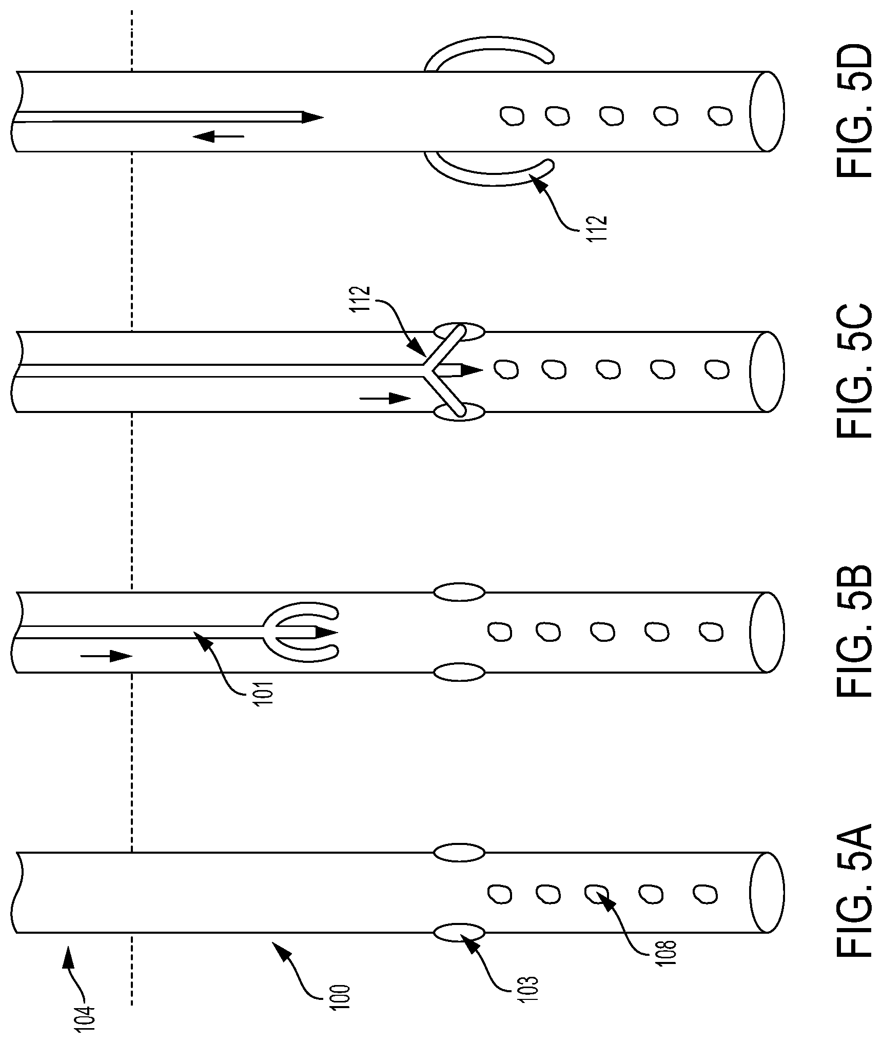 Patent US12090260 Figure 5 – Drainage or infusion catheter and method of use