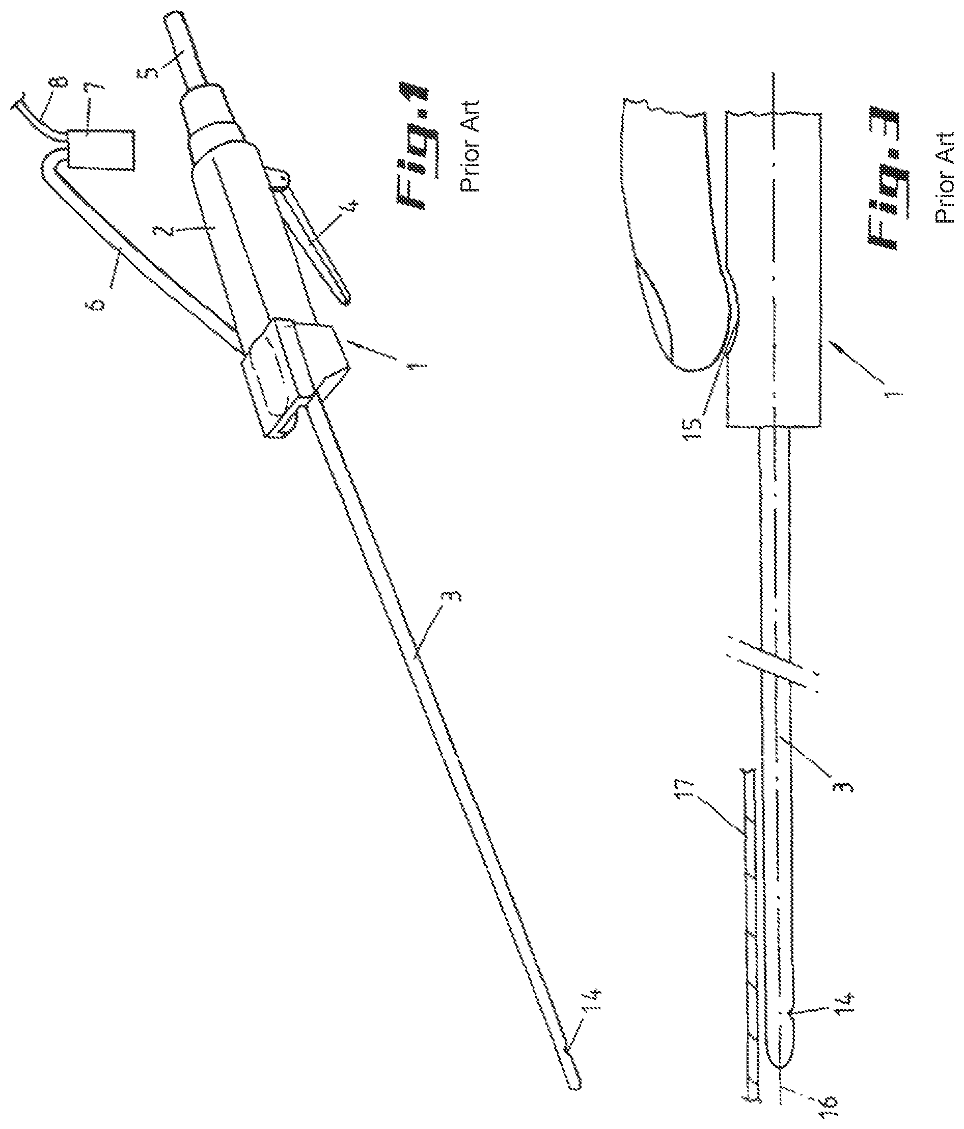 Patent US12090263 Figure 1 – Liposuction apparatus