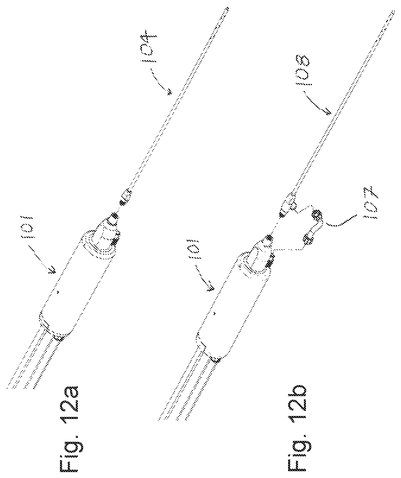 Patent US12090263 Figure 10 – Liposuction apparatus