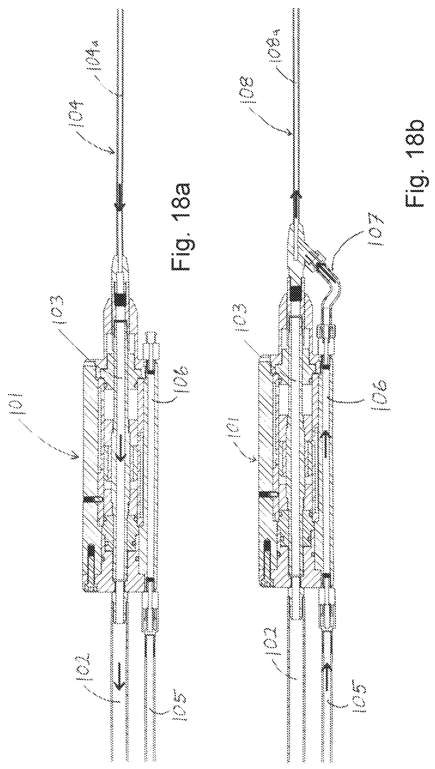 Patent US12090263 Figure 15 – Liposuction apparatus