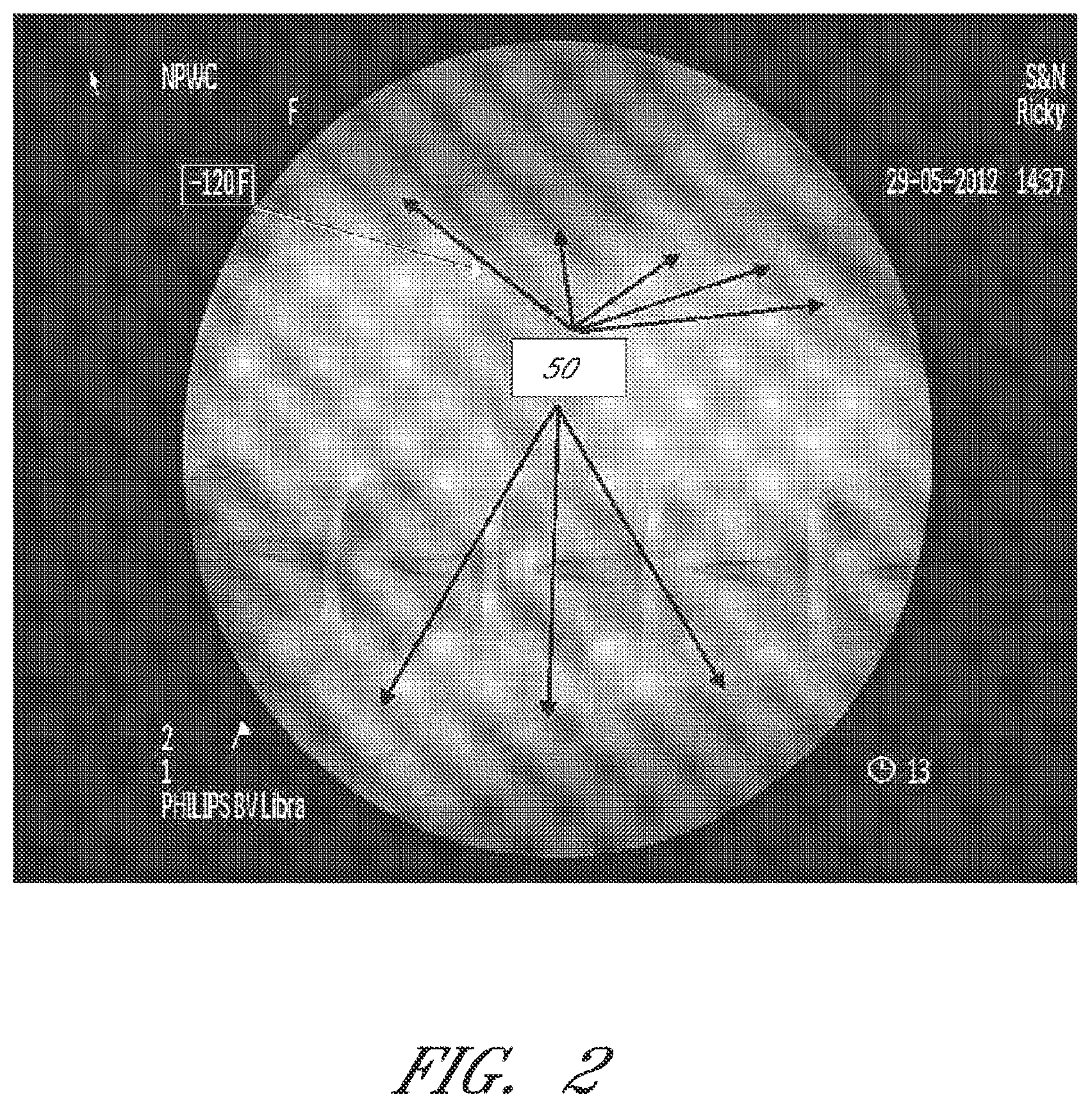 Patent US12090264 Figure 2 – Apparatuses and methods for wound therapy