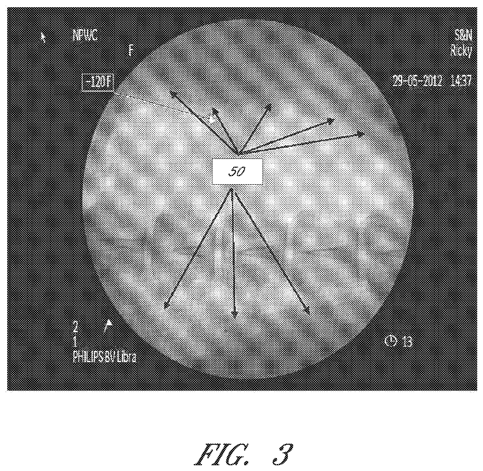 Patent US12090264 Figure 3 – Apparatuses and methods for wound therapy