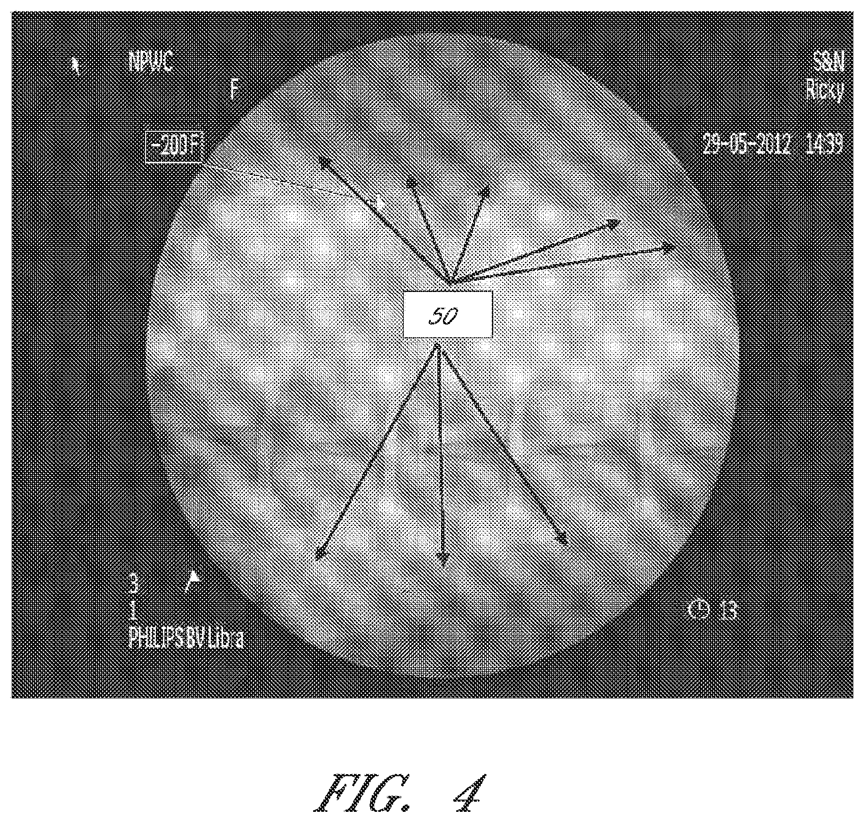 Patent US12090264 Figure 4 – Apparatuses and methods for wound therapy