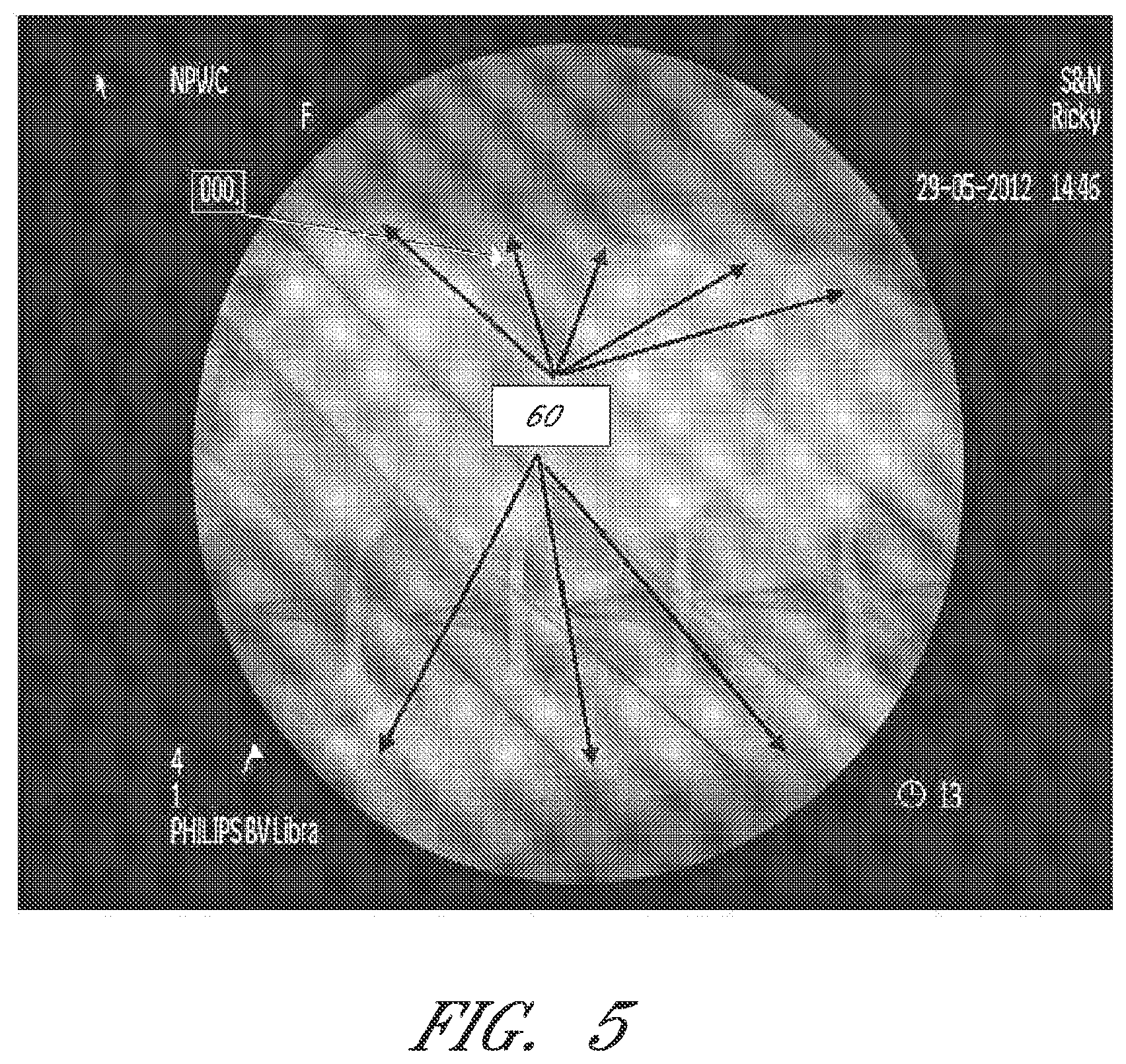 Patent US12090264 Figure 5 – Apparatuses and methods for wound therapy