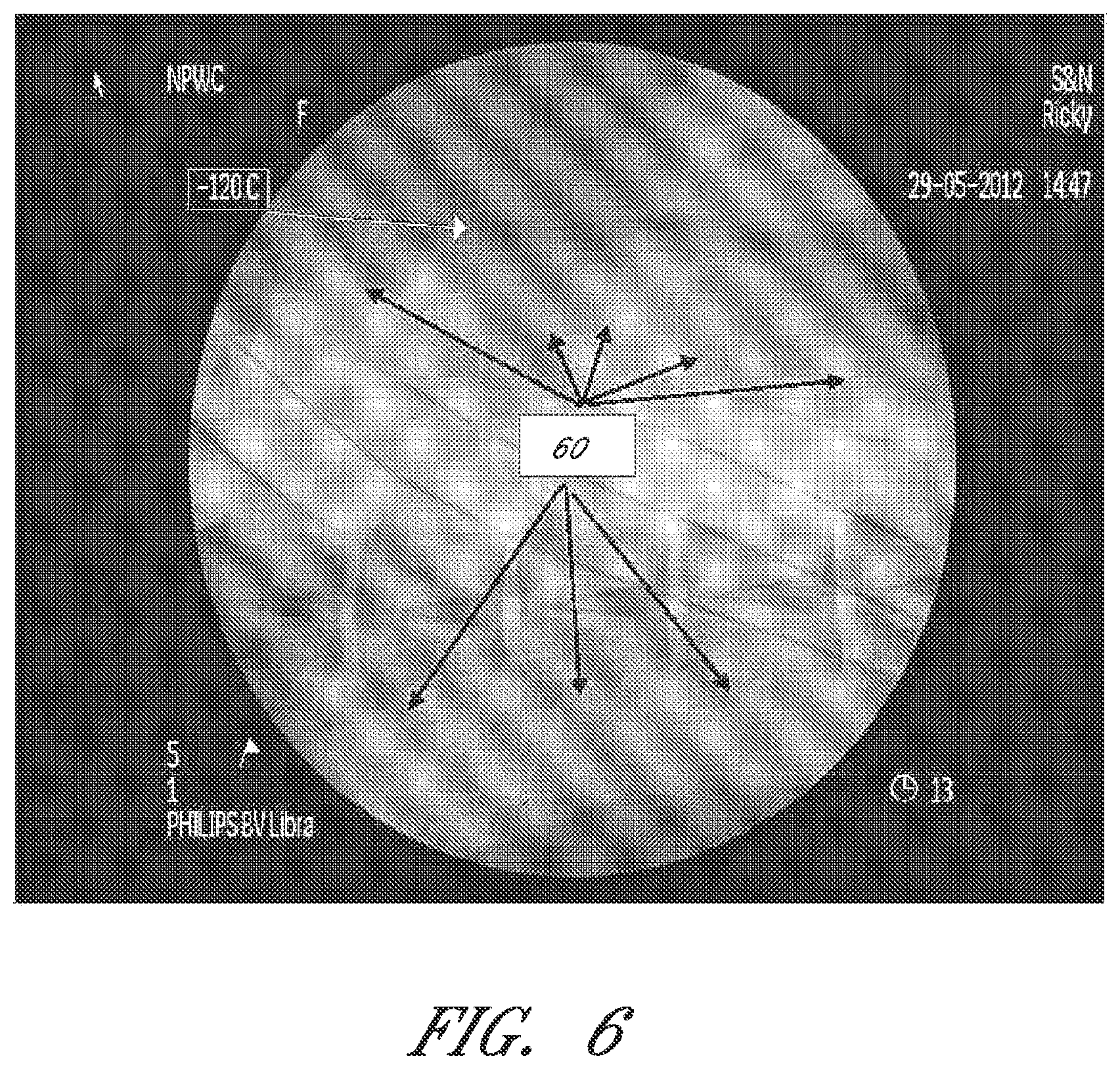 Patent US12090264 Figure 6 – Apparatuses and methods for wound therapy