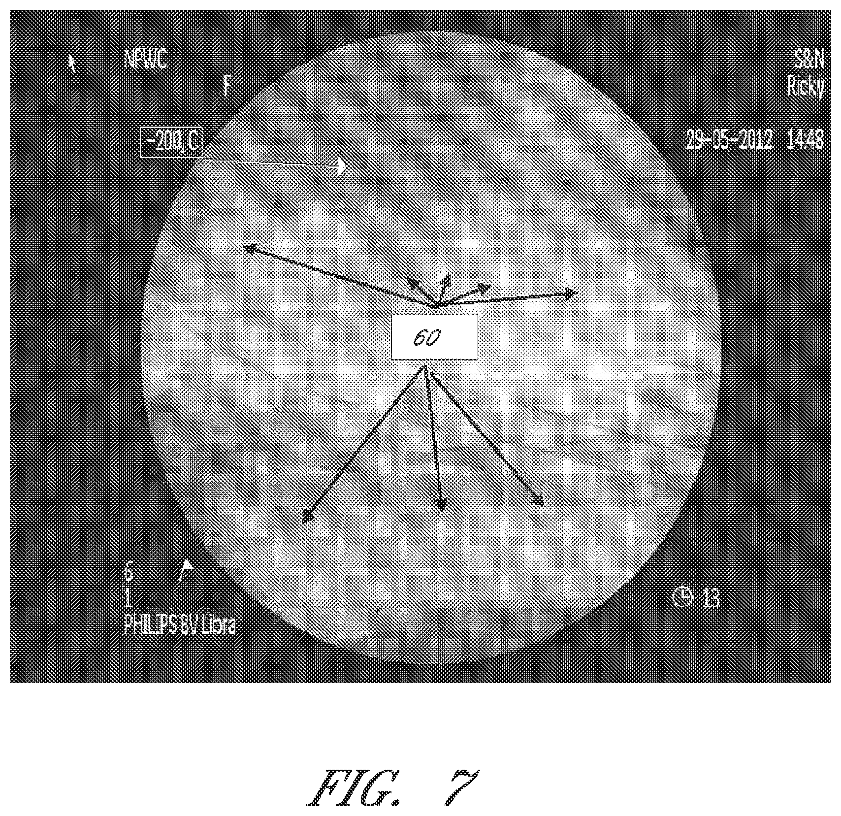 Patent US12090264 Figure 7 – Apparatuses and methods for wound therapy