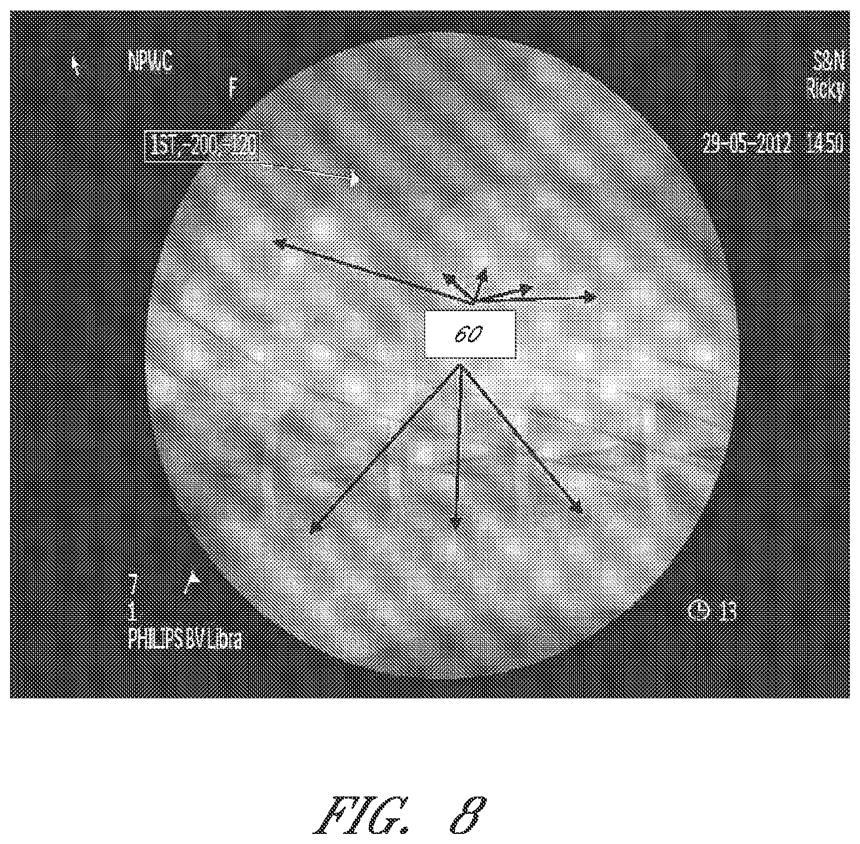 Patent US12090264 Figure 8 – Apparatuses and methods for wound therapy
