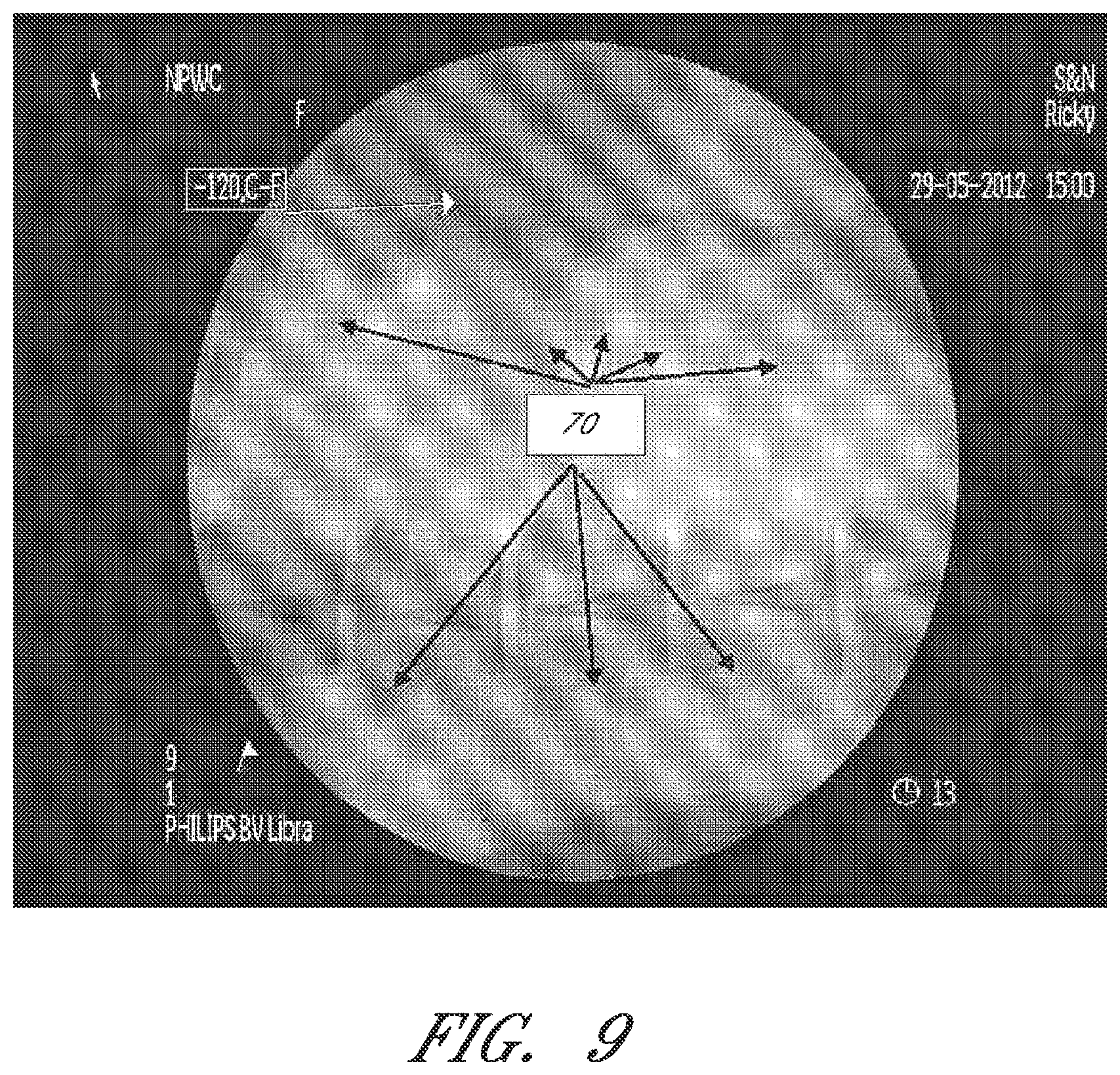 Patent US12090264 Figure 9 – Apparatuses and methods for wound therapy