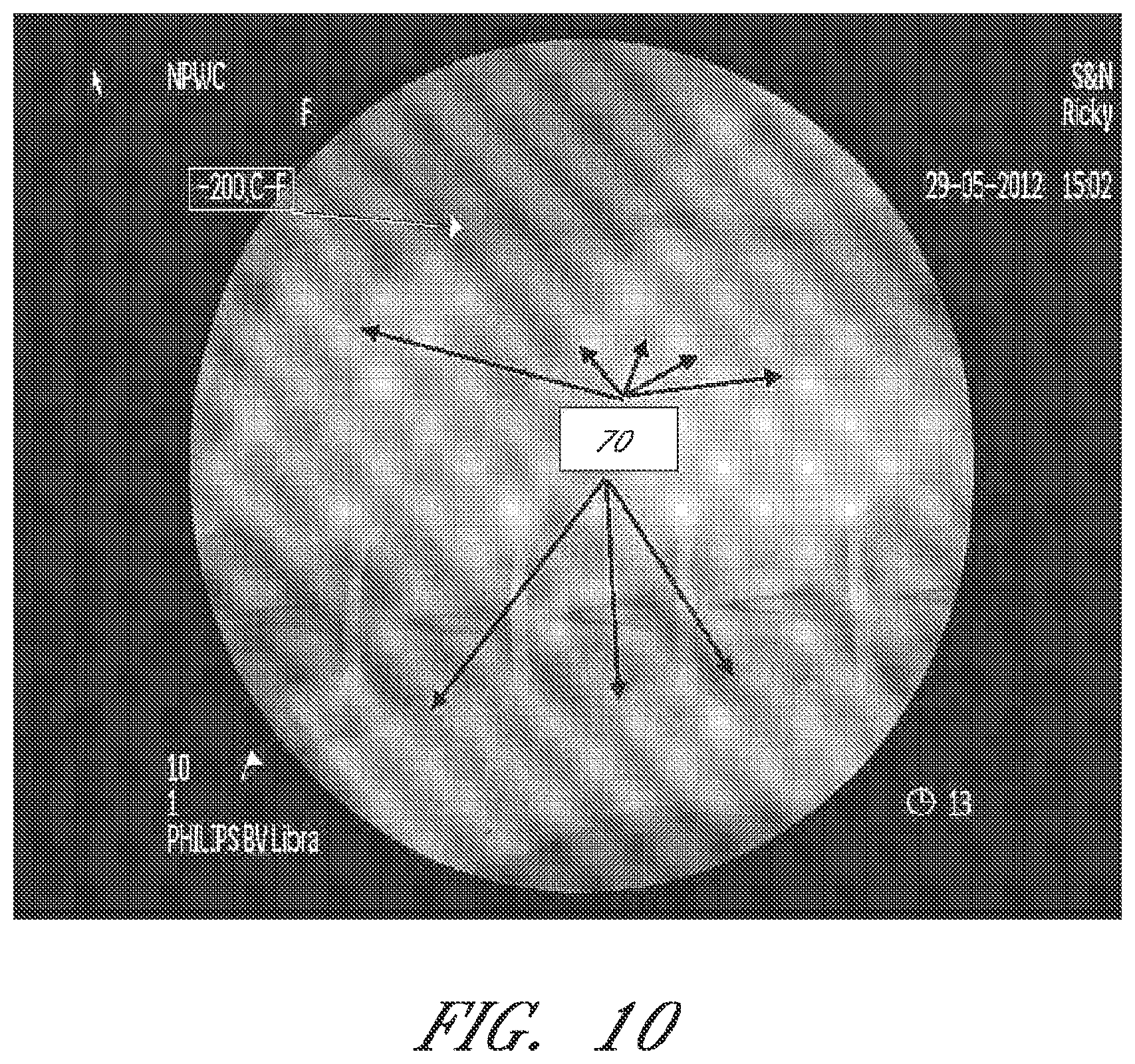 Patent US12090264 Figure 10 – Apparatuses and methods for wound therapy
