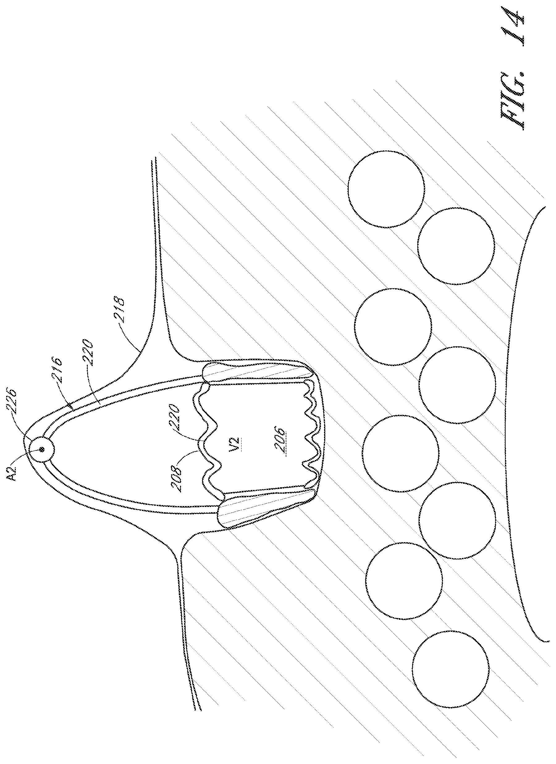 Patent US12090264 Figure 14 – Apparatuses and methods for wound therapy