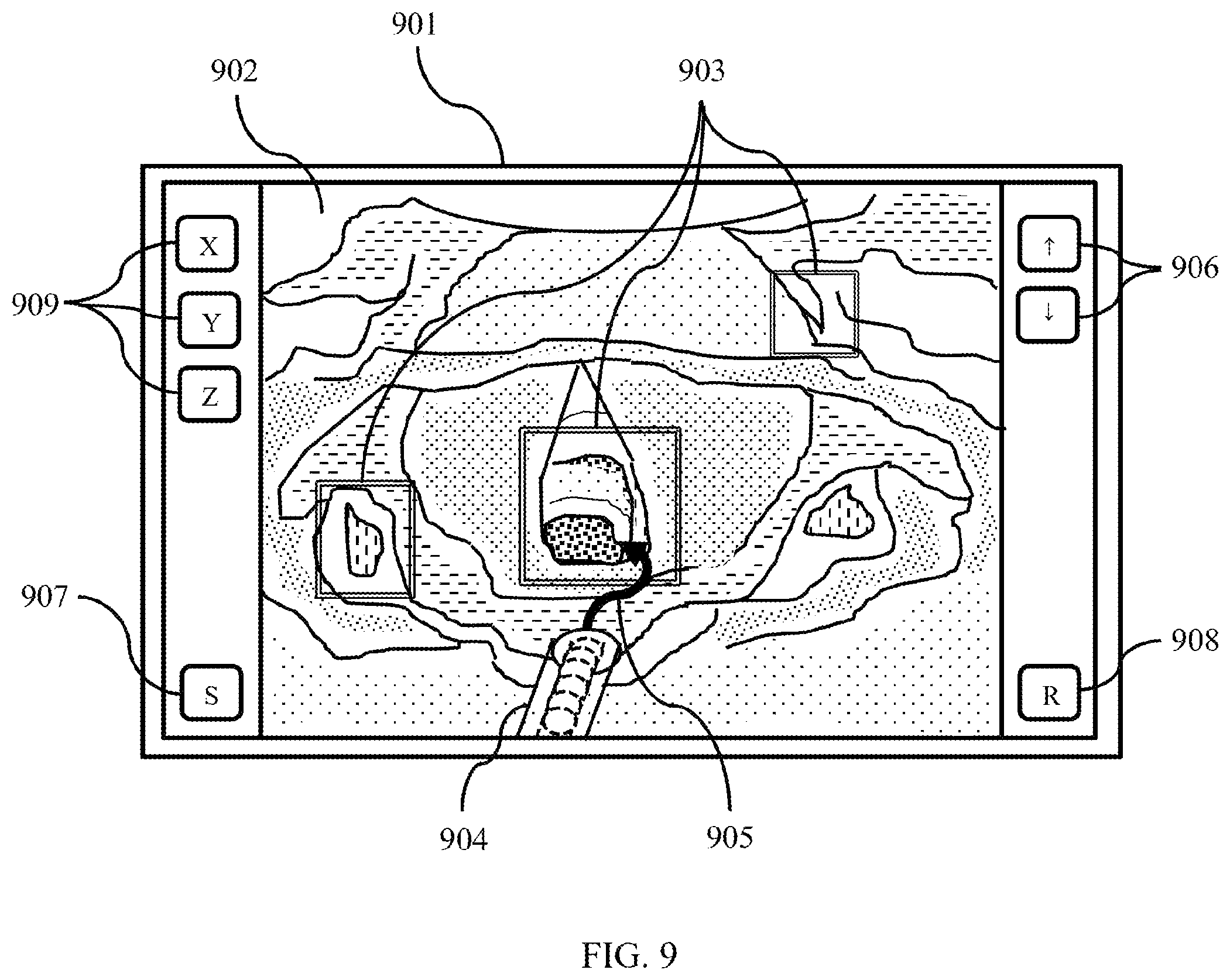 Patent US12090273 Figure 9 – System and method for automated intubation