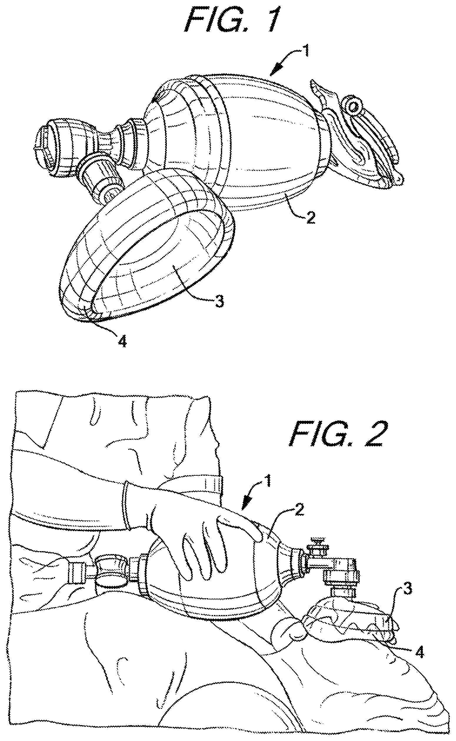 Patent US12090274 Figure 1 – Nasal ventilation mask