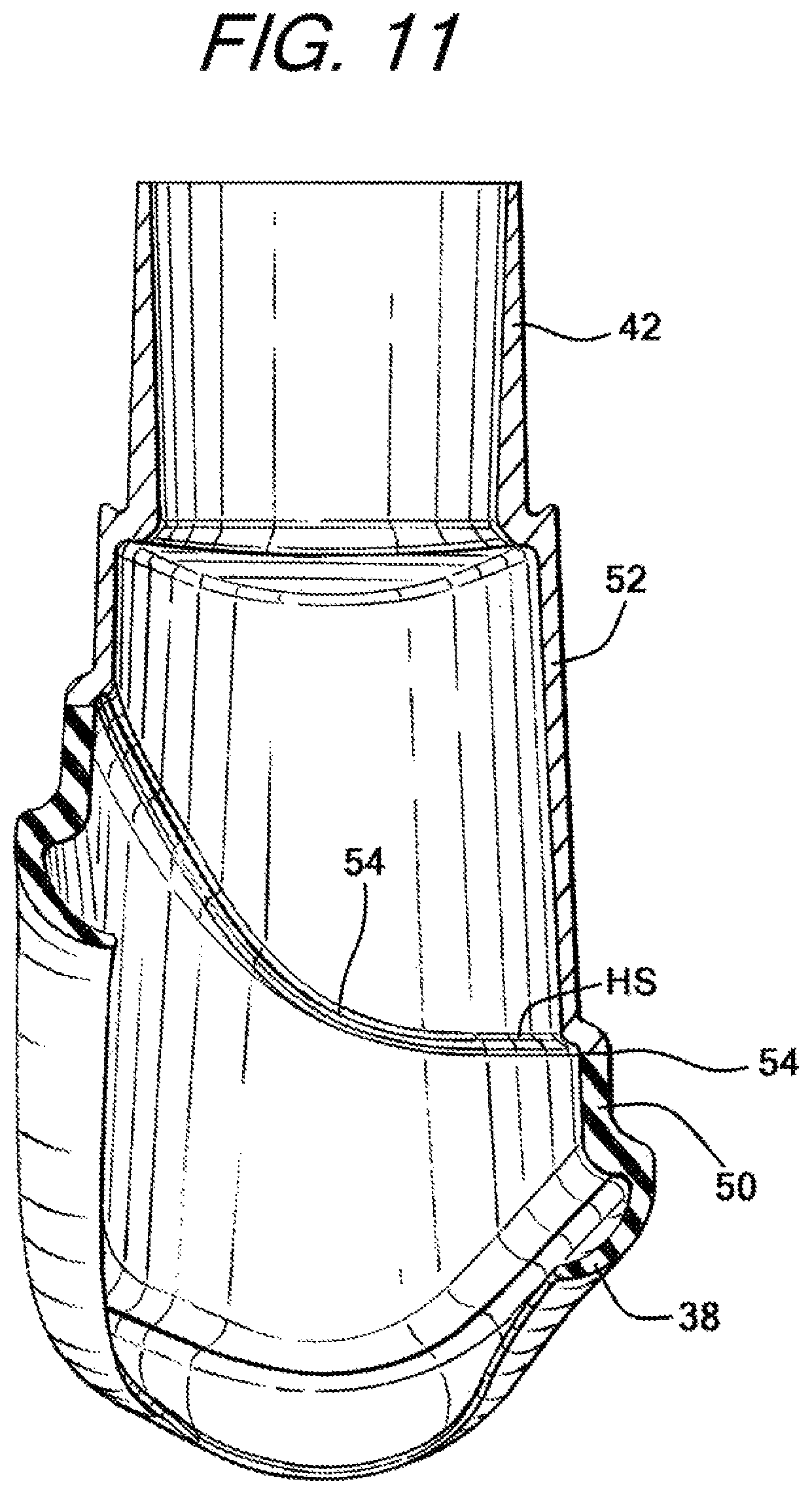 Patent US12090274 Figure 6 – Nasal ventilation mask