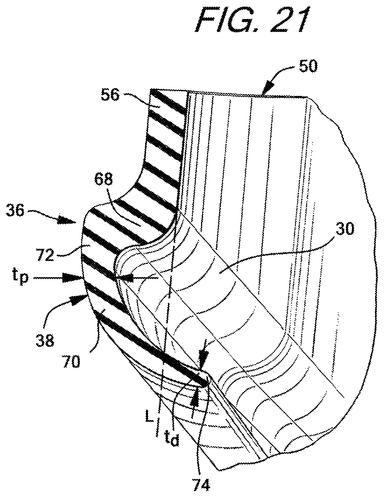 Patent US12090274 Figure 10 – Nasal ventilation mask