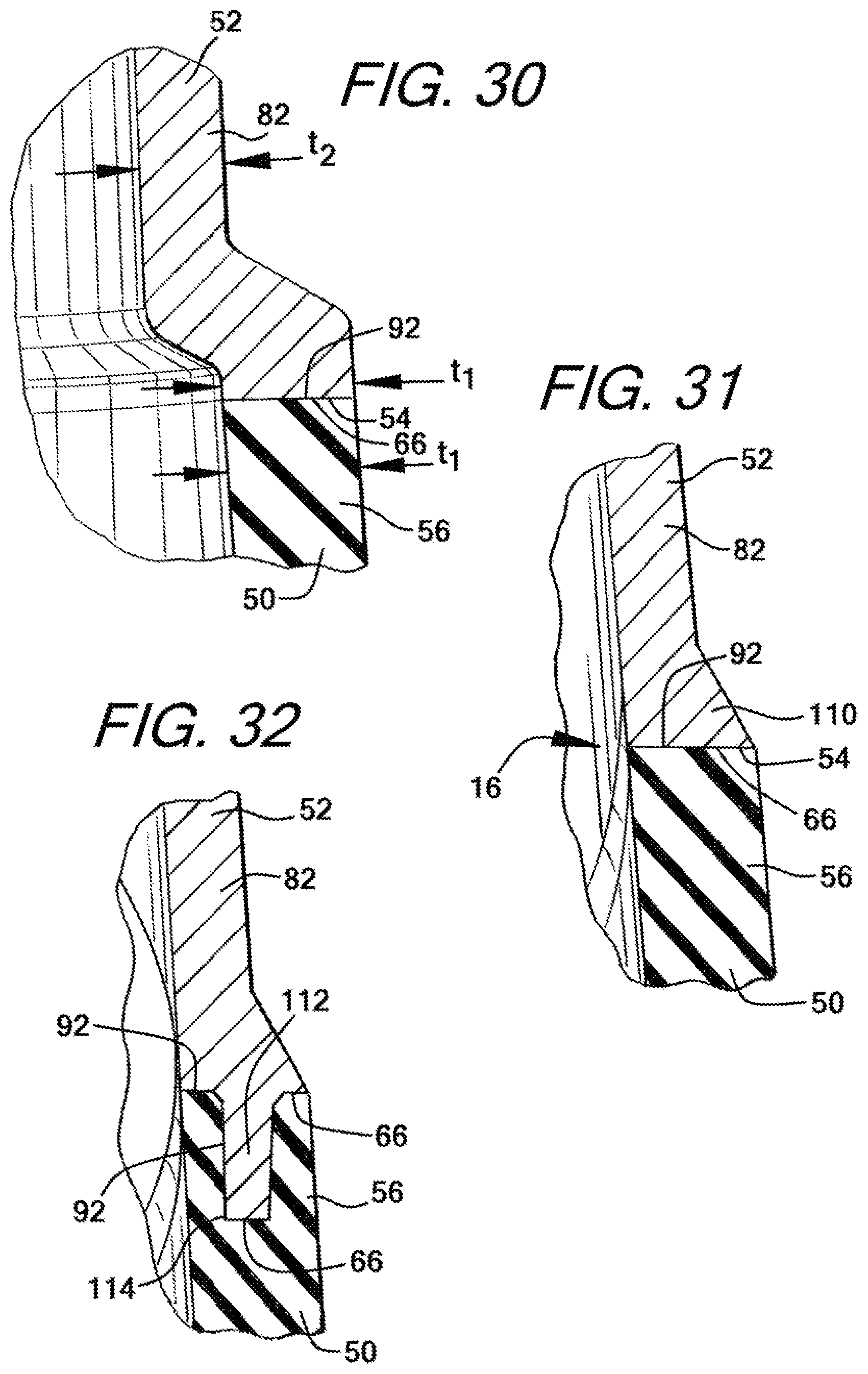 Patent US12090274 Figure 16 – Nasal ventilation mask