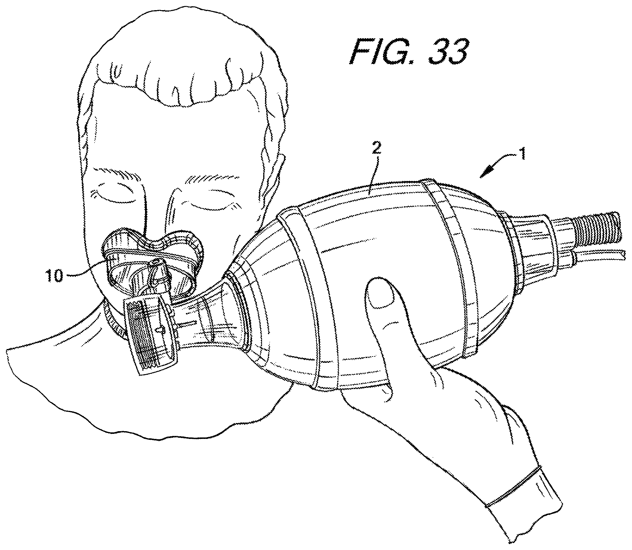 Patent US12090274 Figure 17 – Nasal ventilation mask