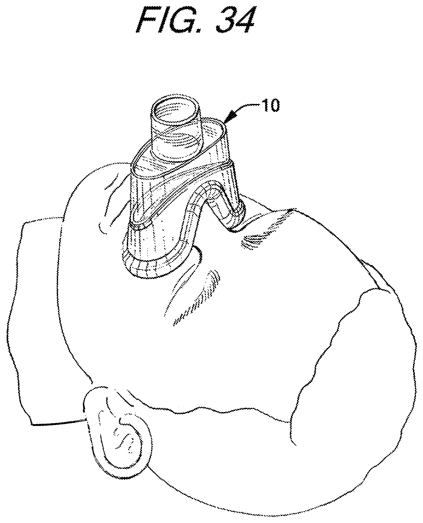 Patent US12090274 Figure 18 – Nasal ventilation mask