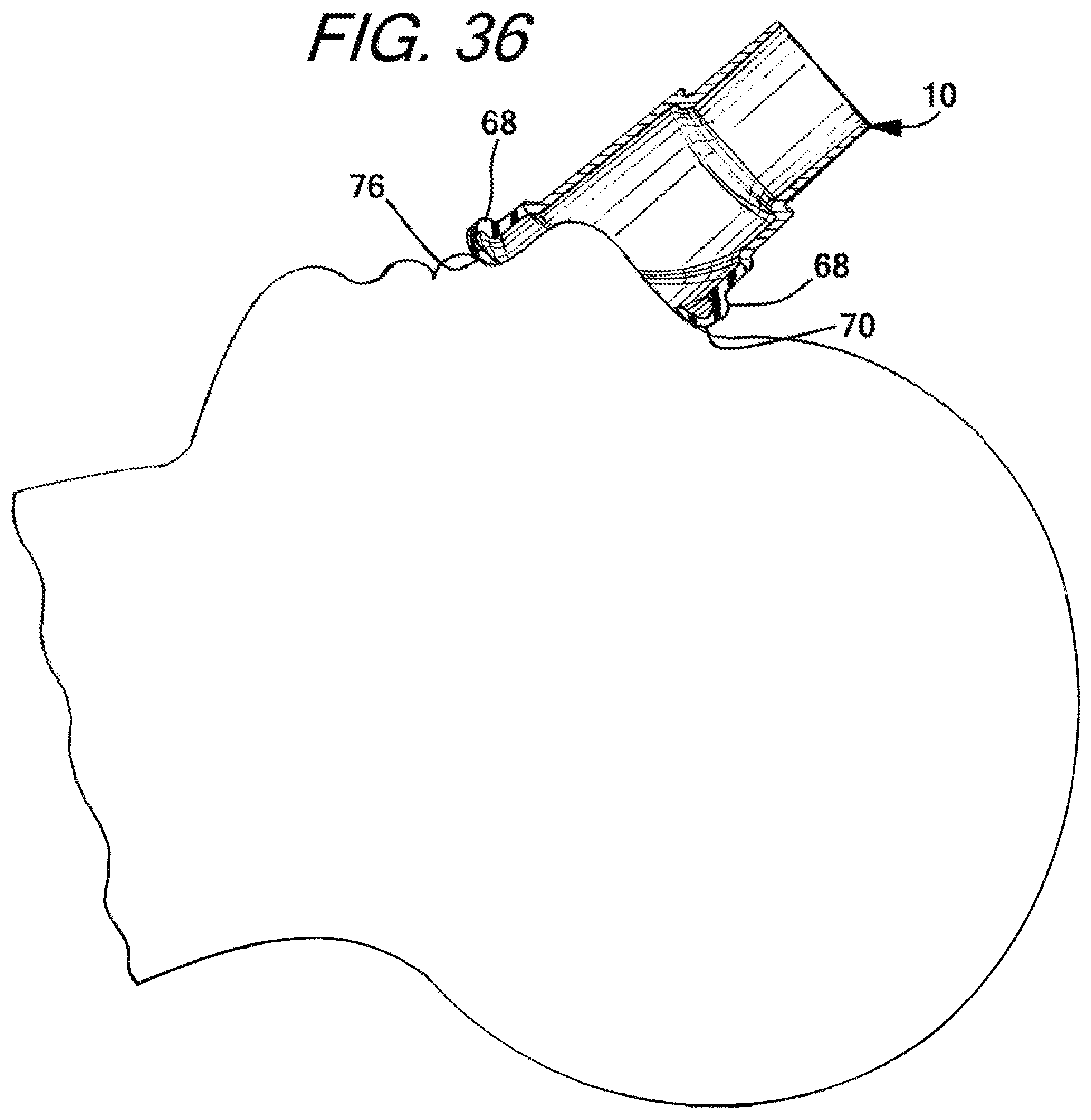 Patent US12090274 Figure 19 – Nasal ventilation mask