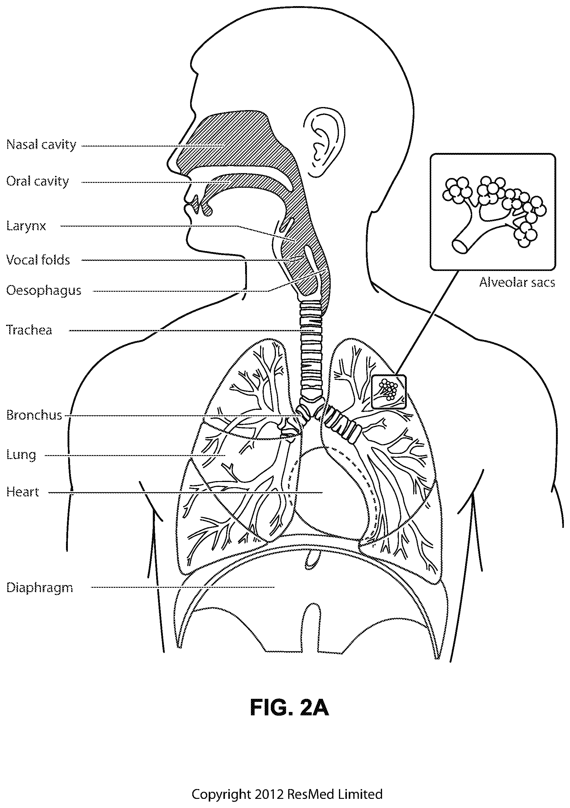 Patent US12090275 Figure 4 – Patient interface