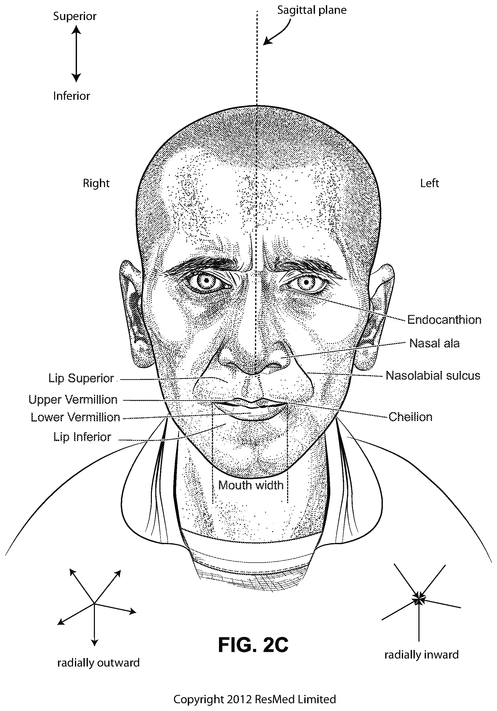 Patent US12090275 Figure 6 – Patient interface