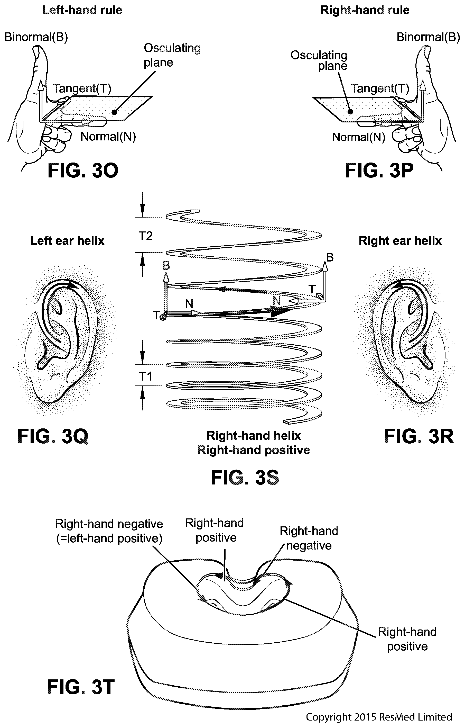 Patent US12090275 Figure 17 – Patient interface