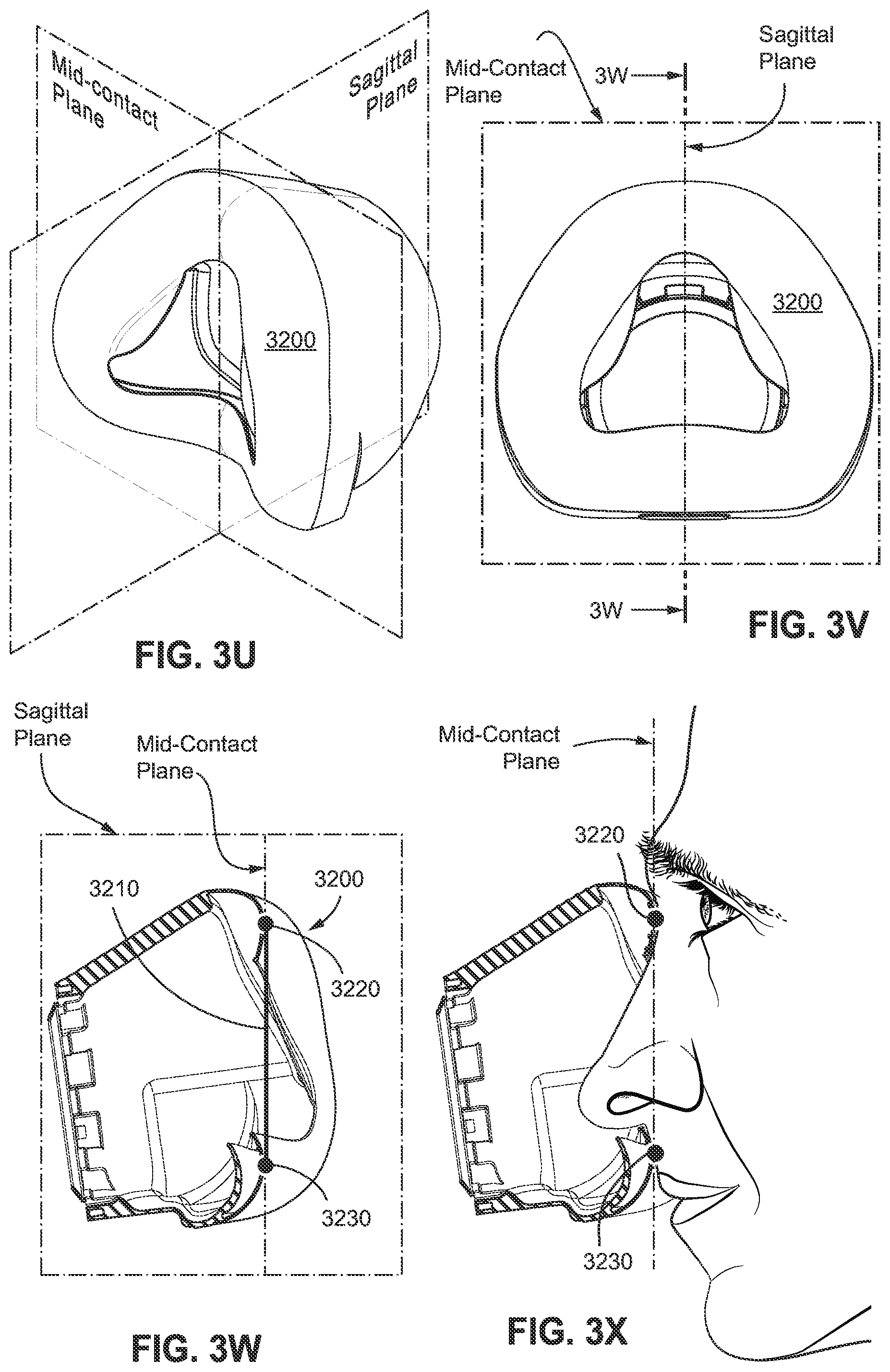 Patent US12090275 Figure 18 – Patient interface