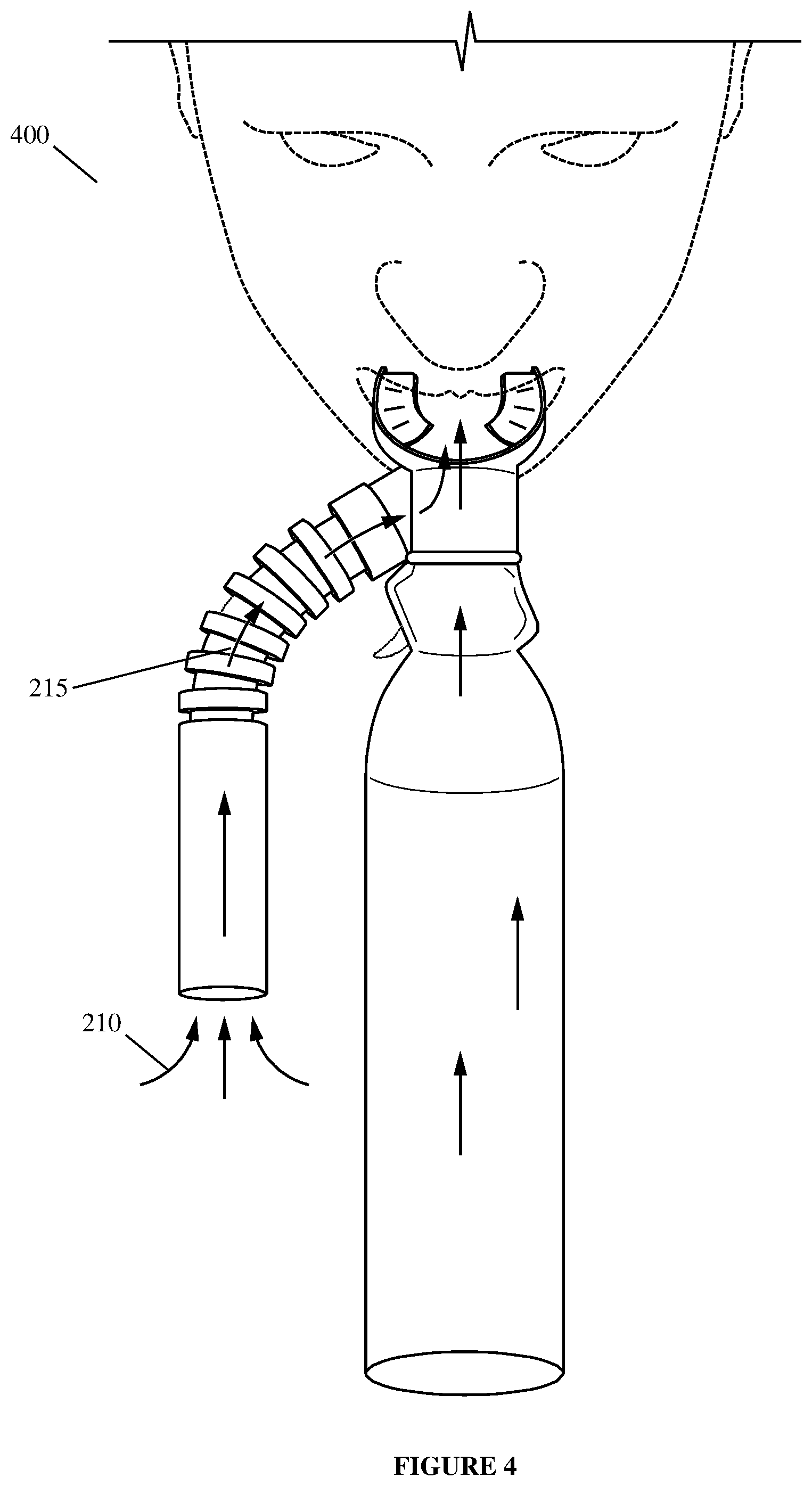 Patent US12090276 Figure 4 – Highly portable gas delivery systems