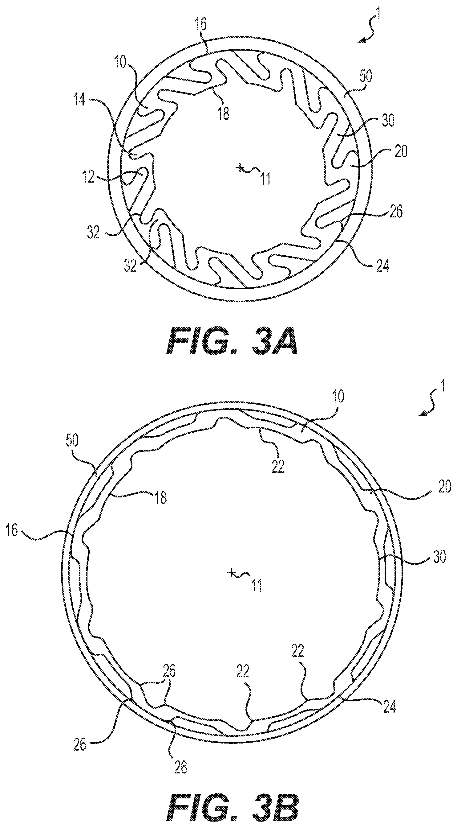Patent US12090282 Figure 3 – Expandable sheath