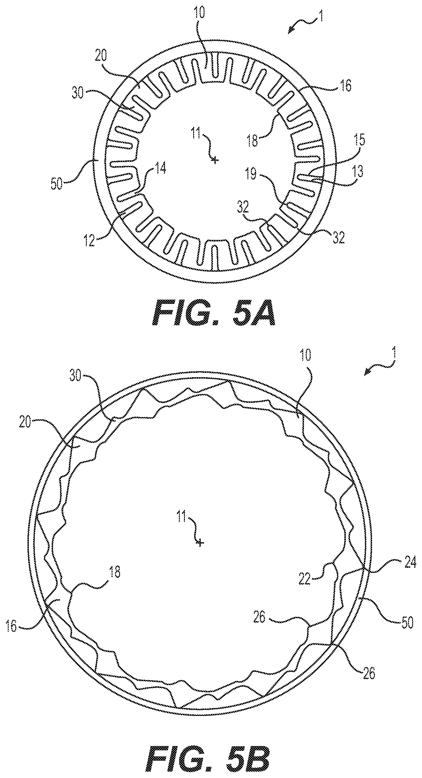 Patent US12090282 Figure 5 – Expandable sheath
