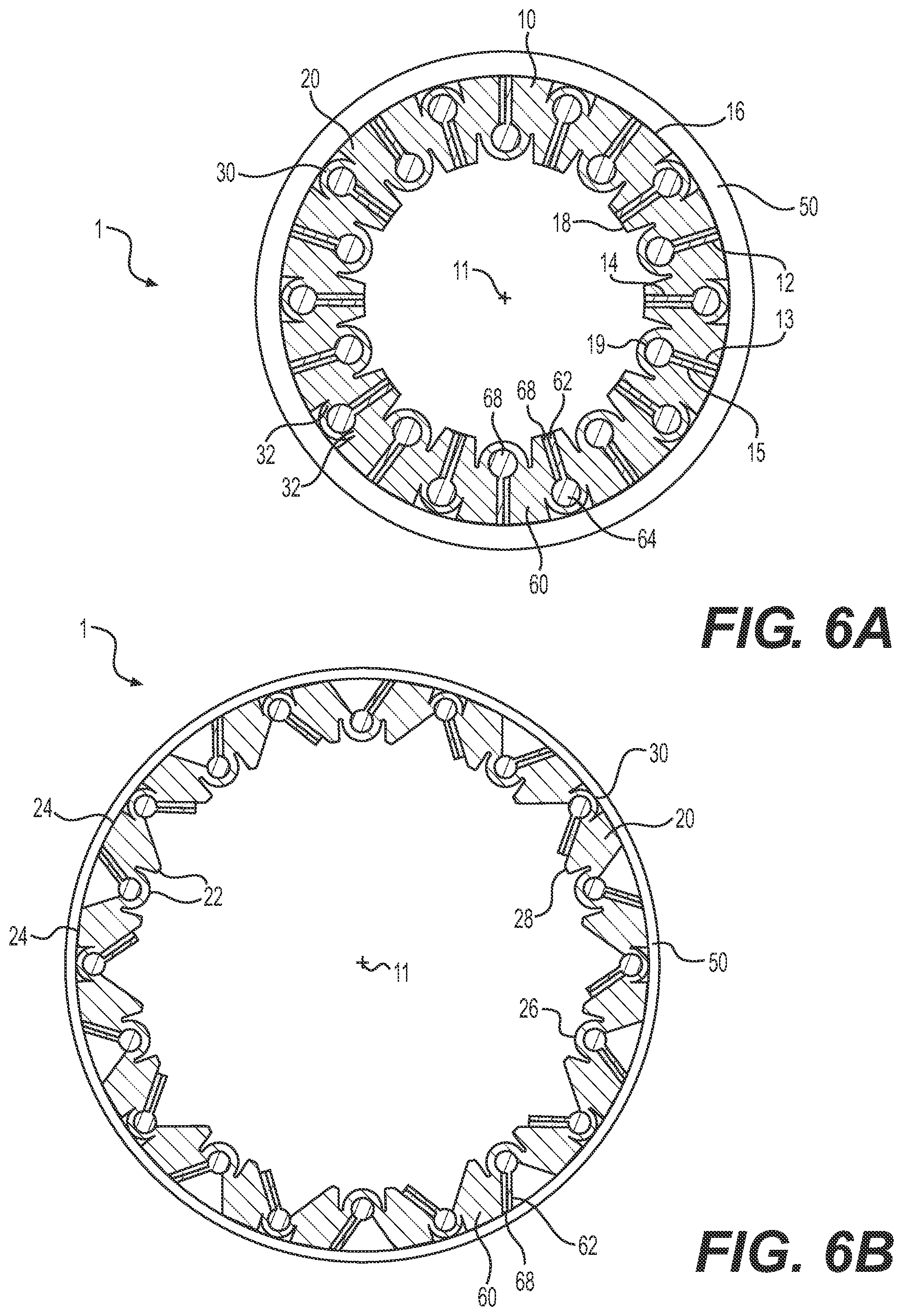 Patent US12090282 Figure 6 – Expandable sheath