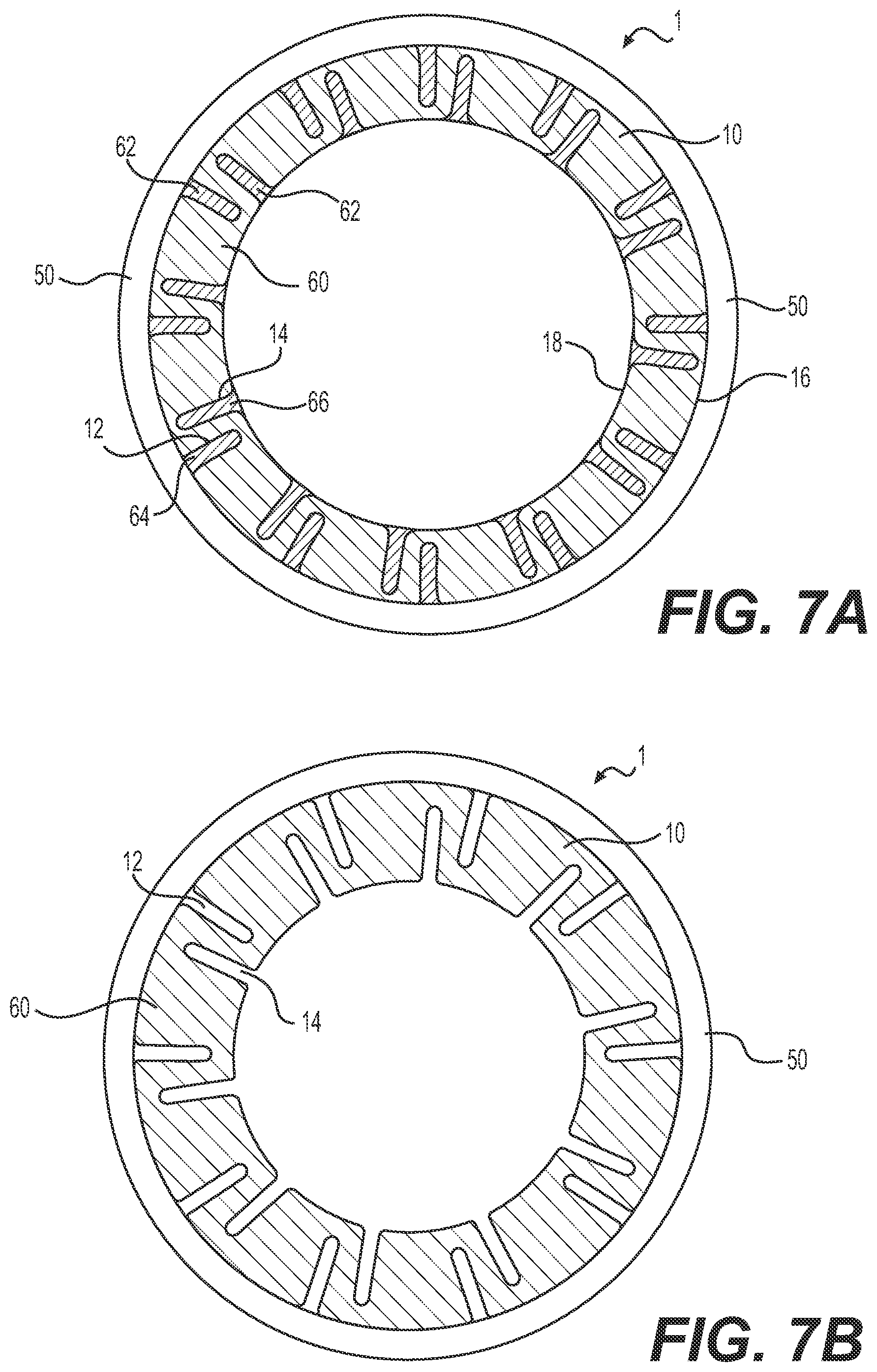 Patent US12090282 Figure 7 – Expandable sheath
