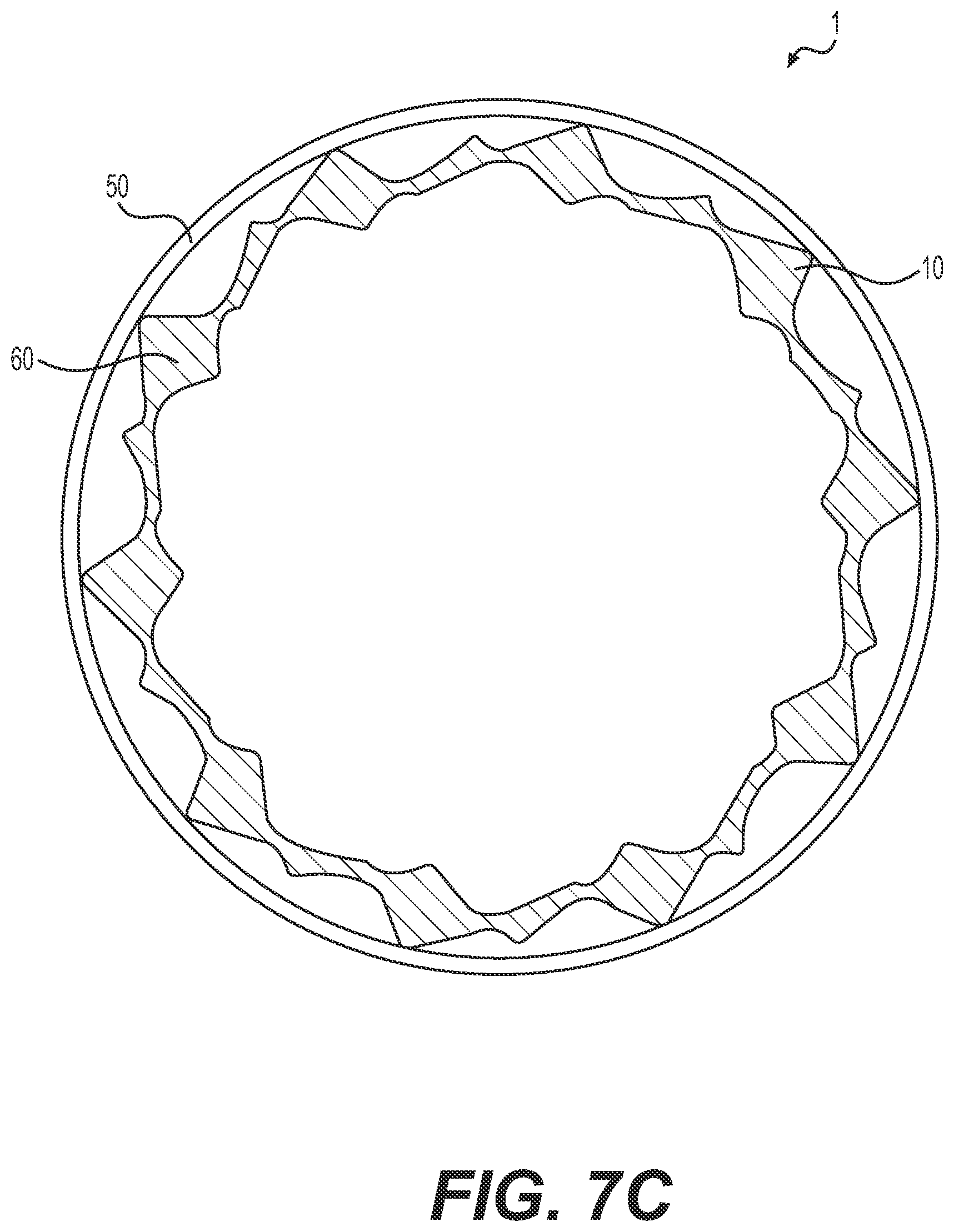 Patent US12090282 Figure 8 – Expandable sheath
