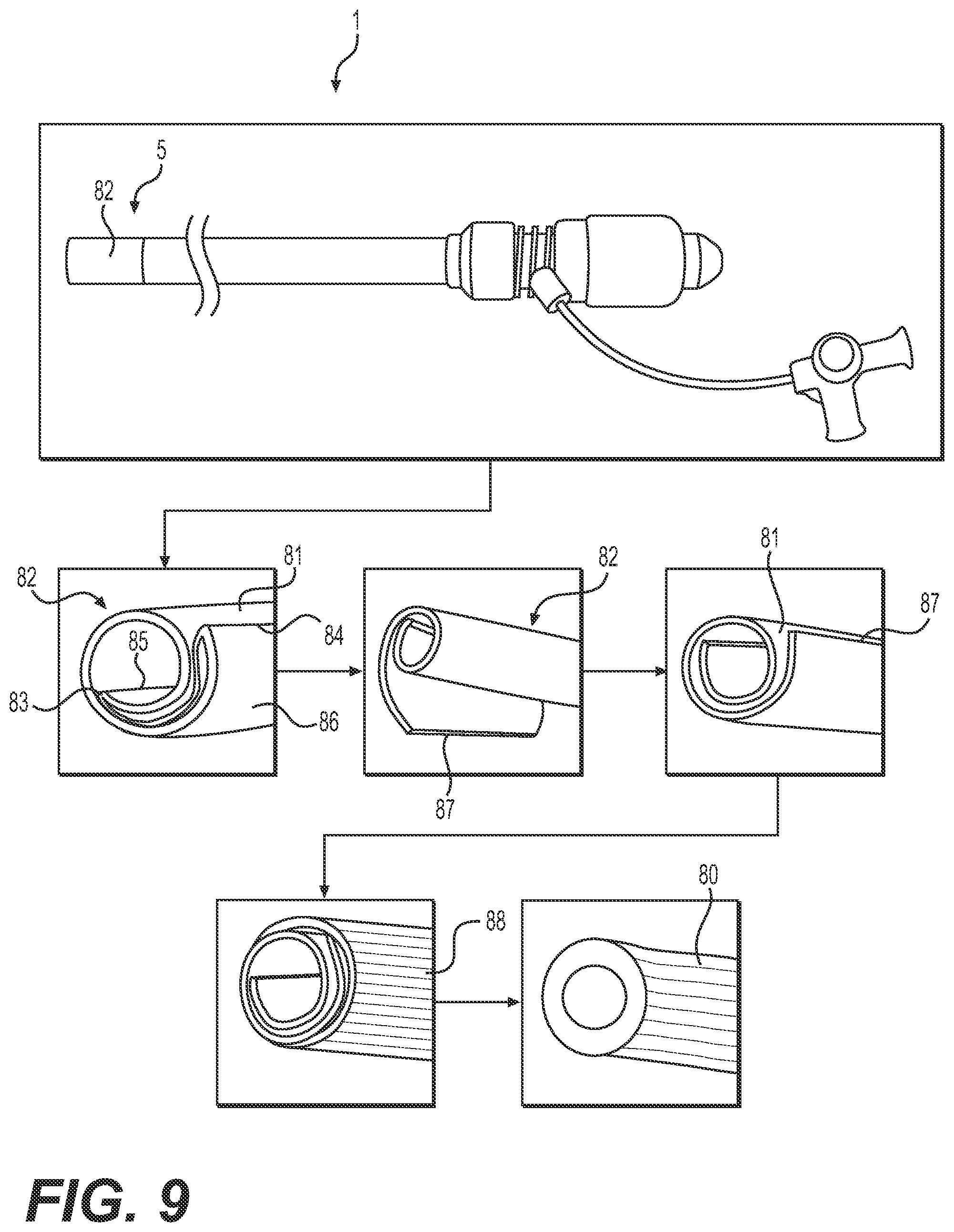 Patent US12090282 Figure 10 – Expandable sheath