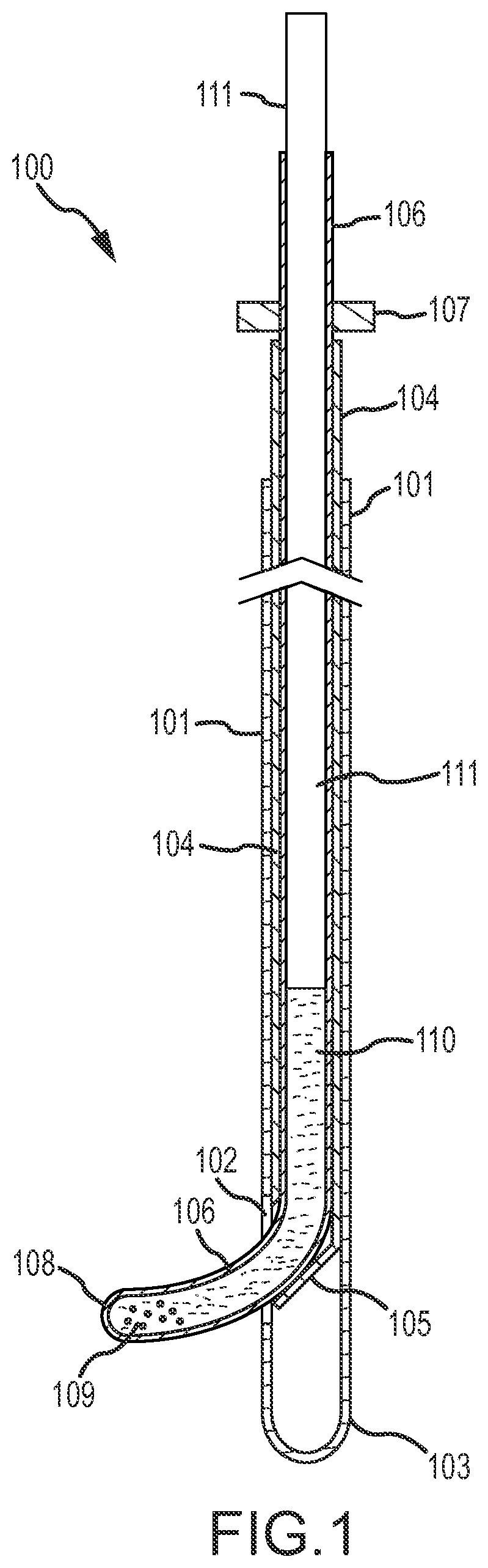 Patent US12090283 Figure 1 – Microinjection catheter