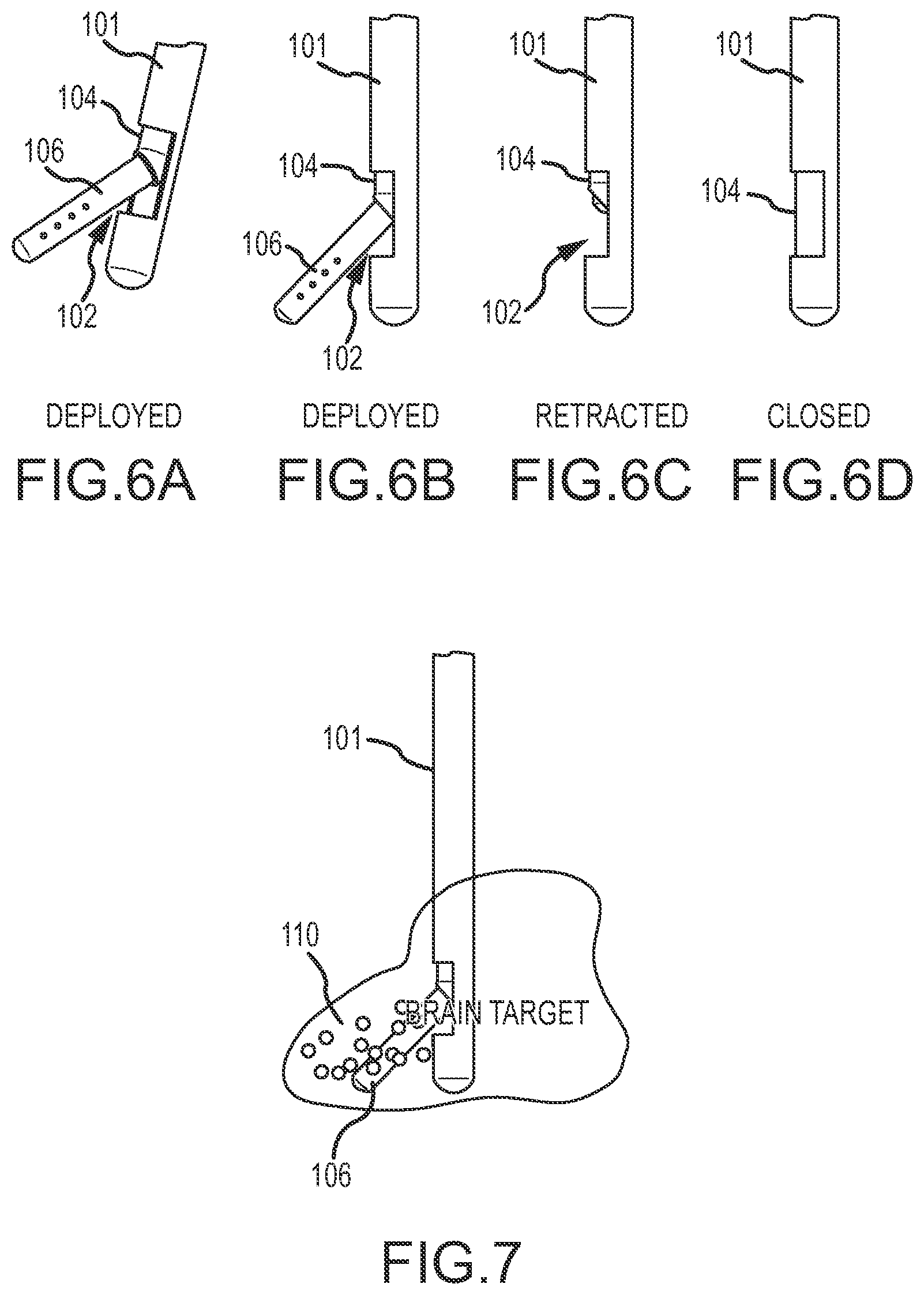 Patent US12090283 Figure 5 – Microinjection catheter