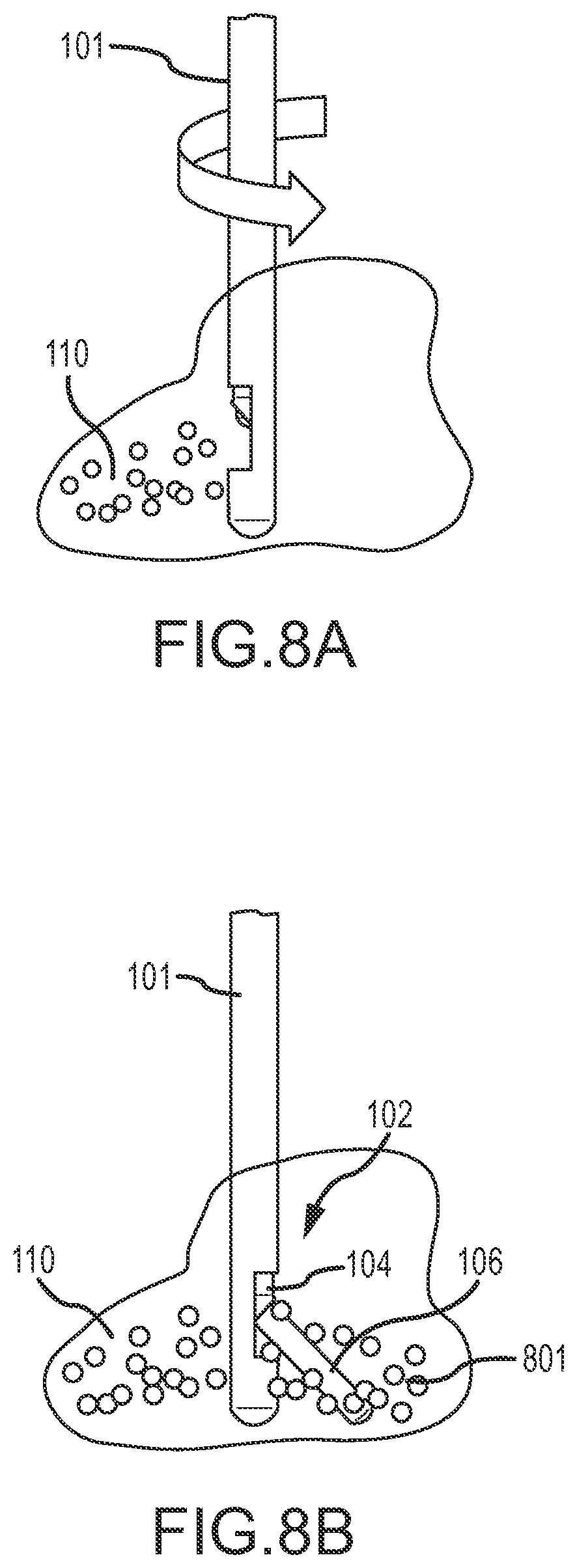 Patent US12090283 Figure 6 – Microinjection catheter