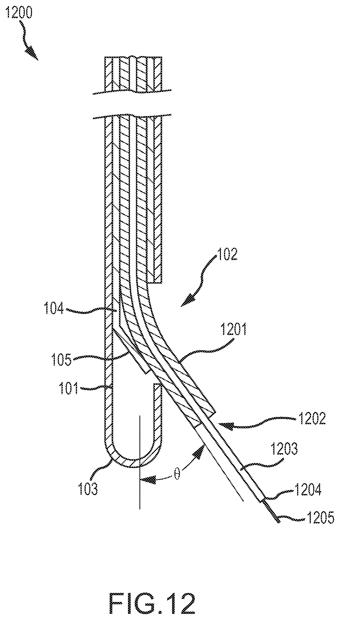 Patent US12090283 Figure 9 – Microinjection catheter