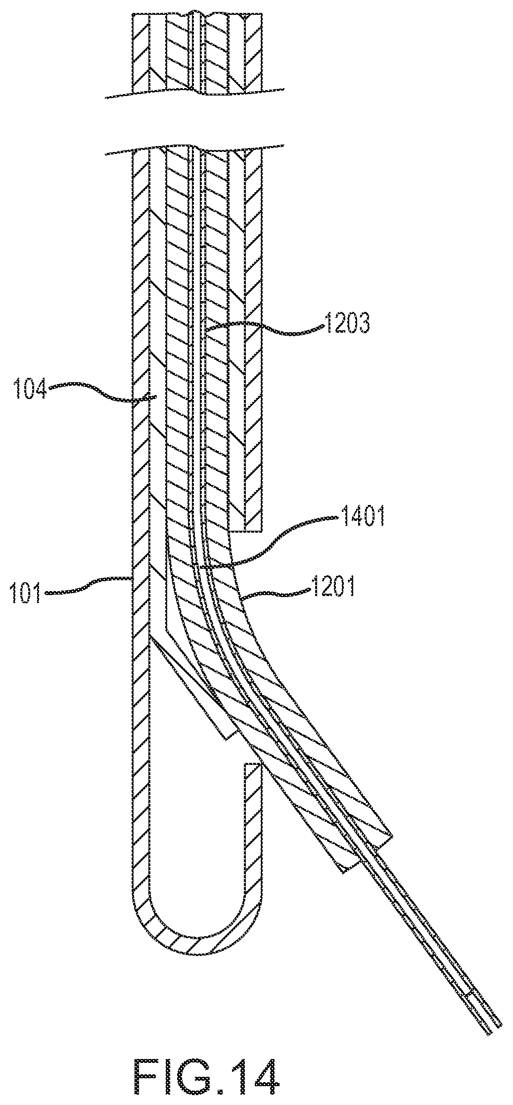 Patent US12090283 Figure 11 – Microinjection catheter